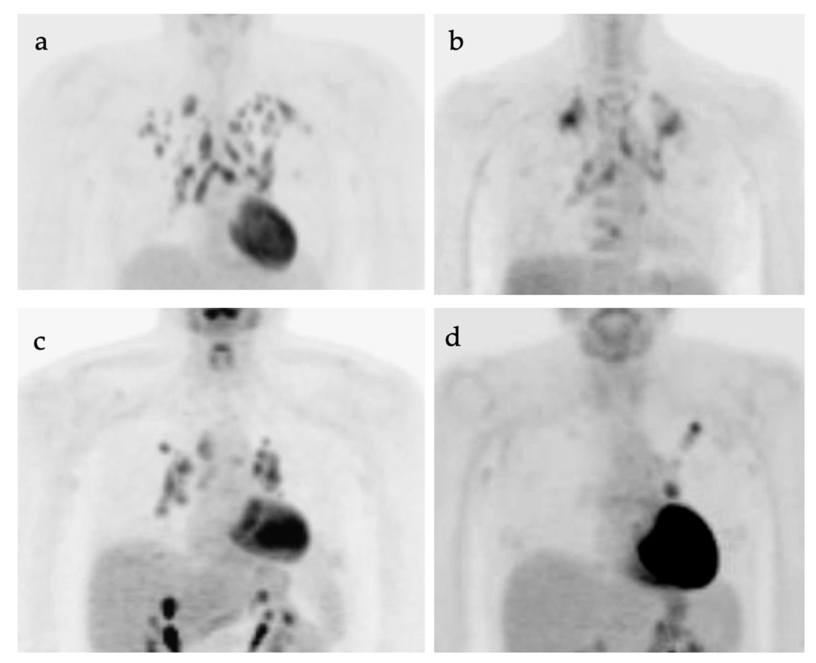 Cancers 14 02689 g002 Cancers 14 02689 g002