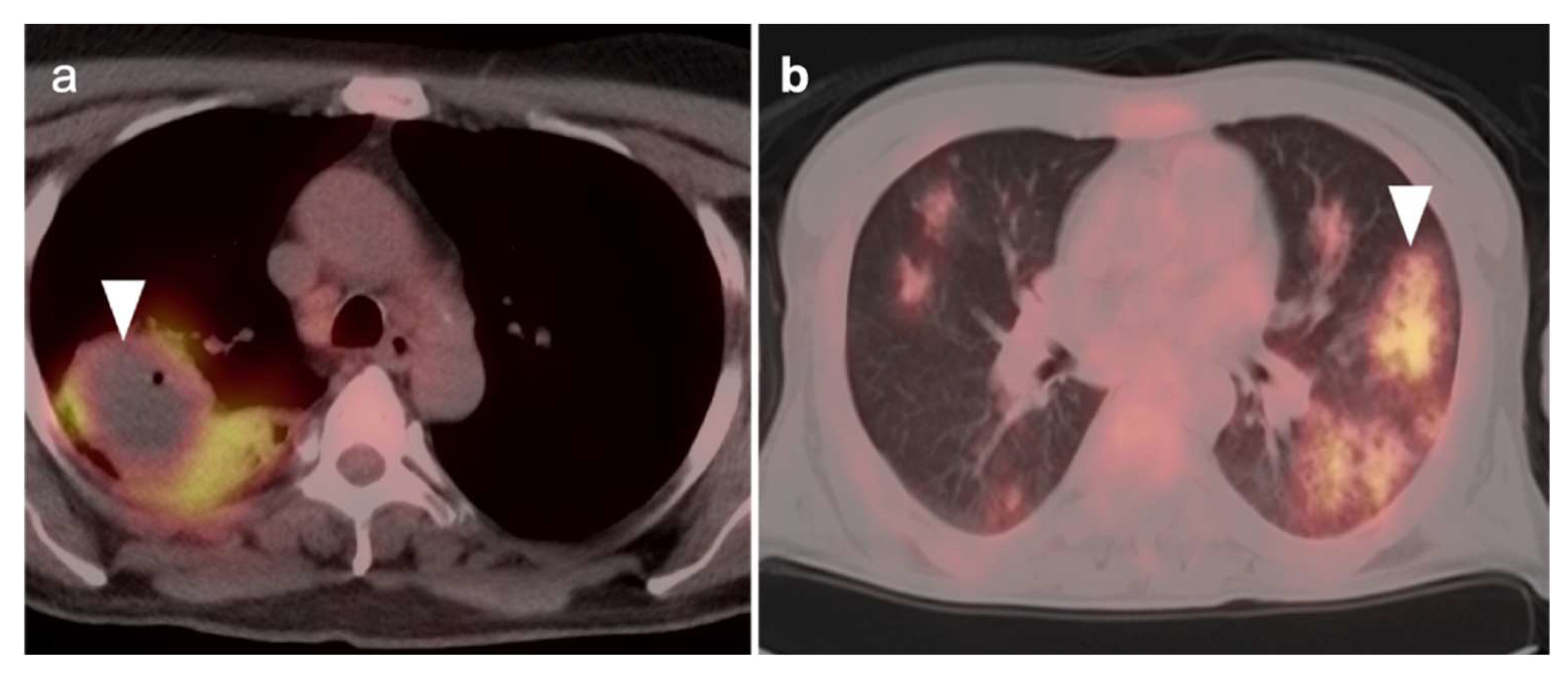 Cancers 14 02689 g004 Cancers 14 02689 g004