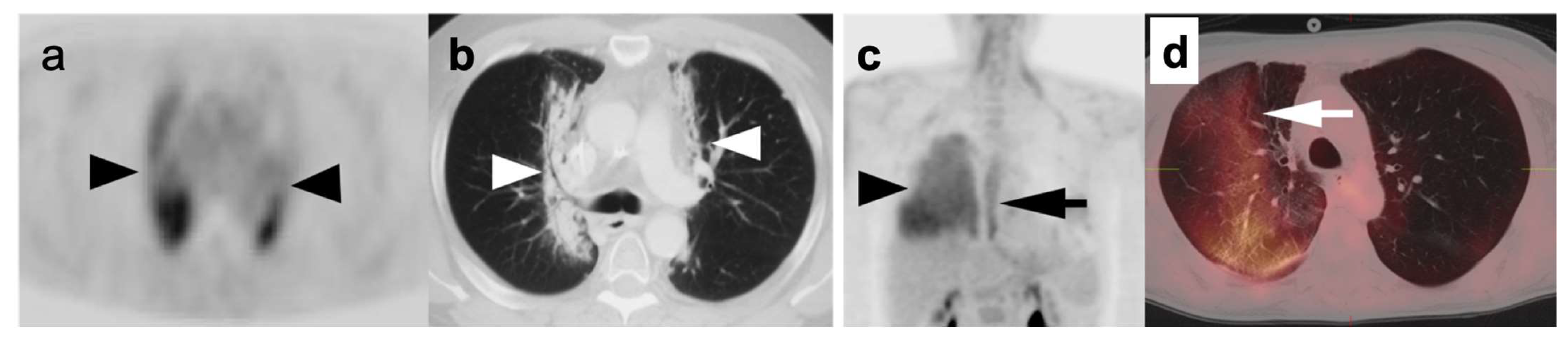 Cancers 14 02689 g005 Cancers 14 02689 g005