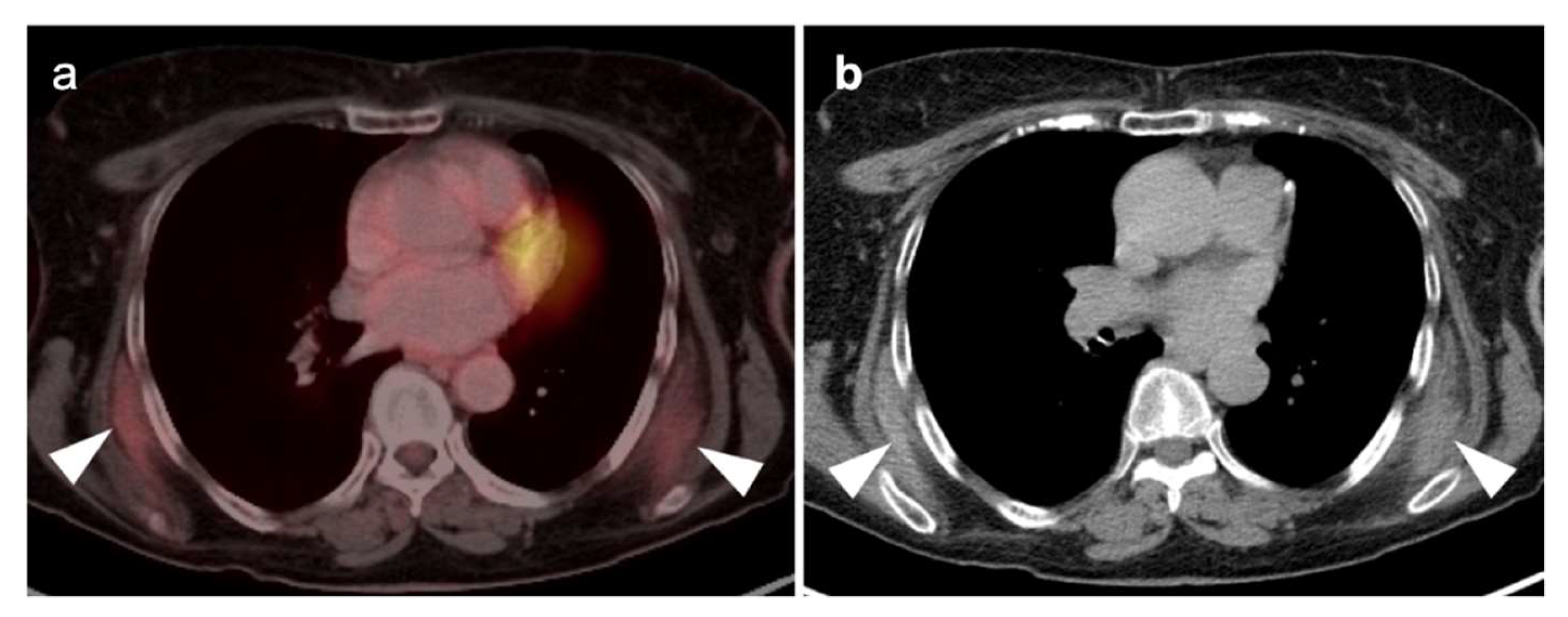 Cancers 14 02689 g006 Cancers 14 02689 g006