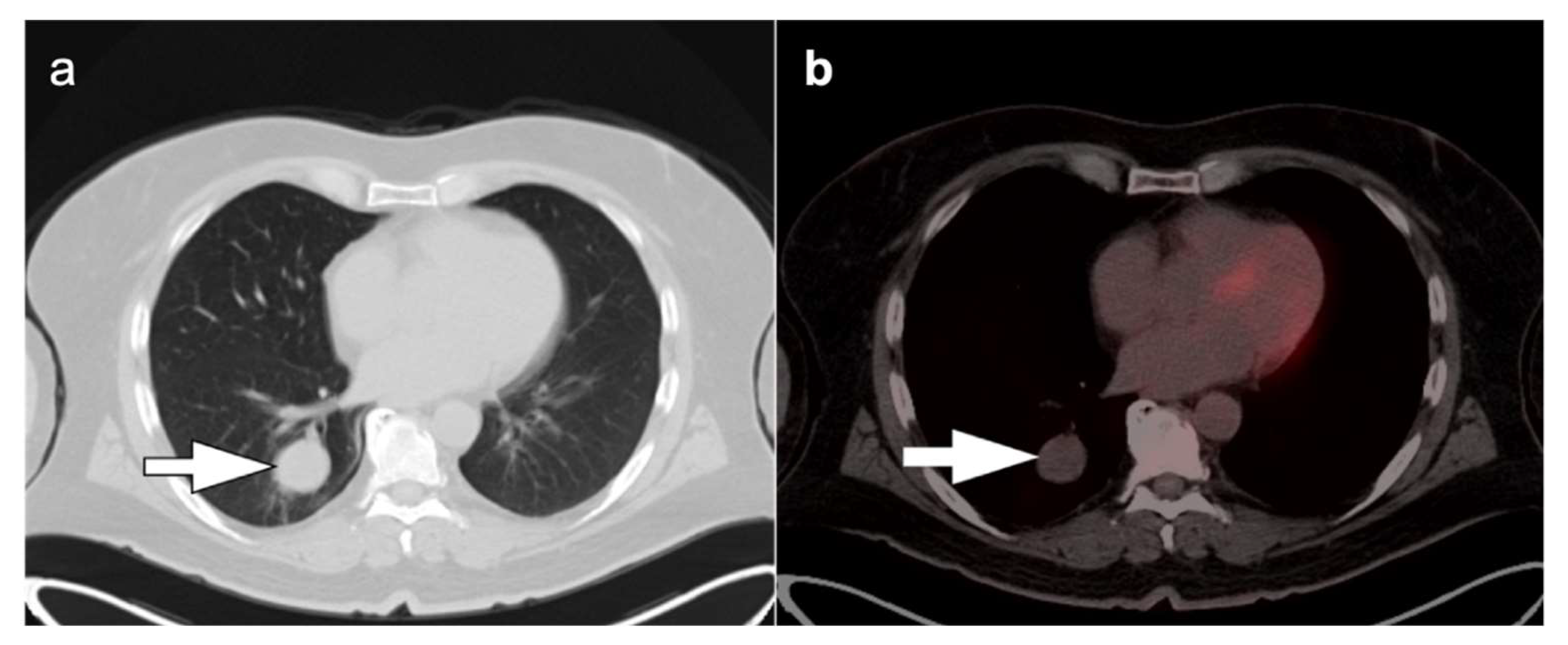 Cancers 14 02689 g007 Cancers 14 02689 g007