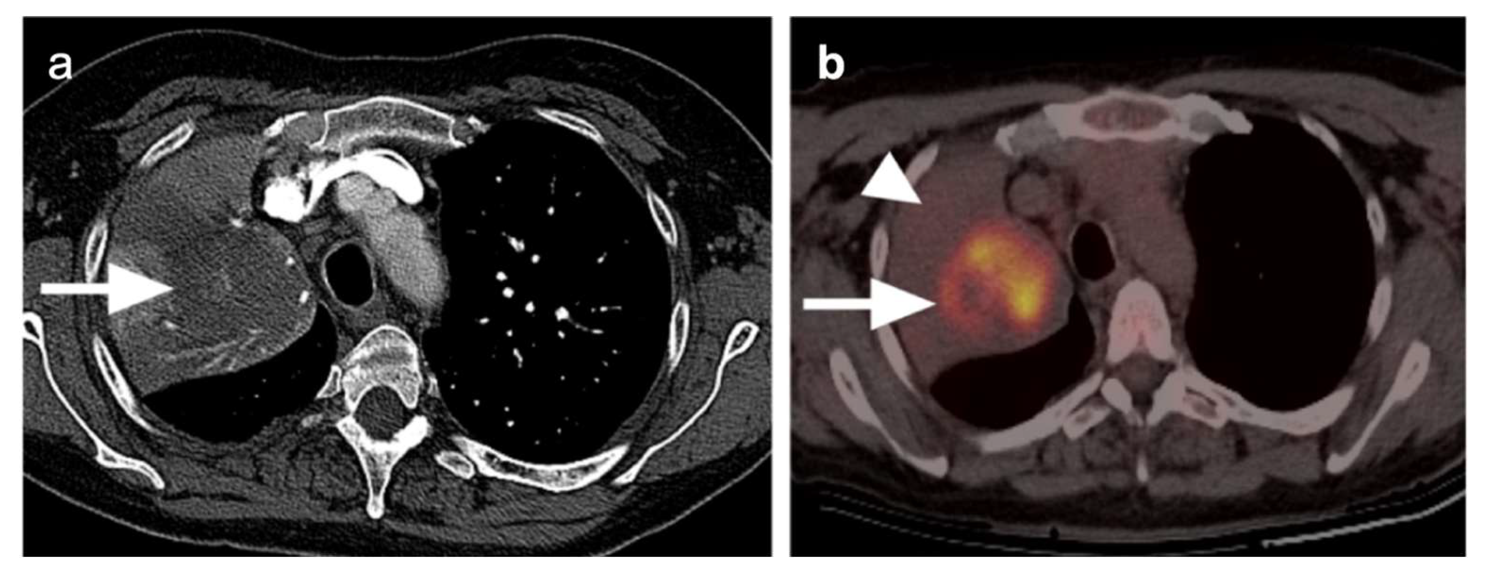 Cancers 14 02689 g008 Cancers 14 02689 g008