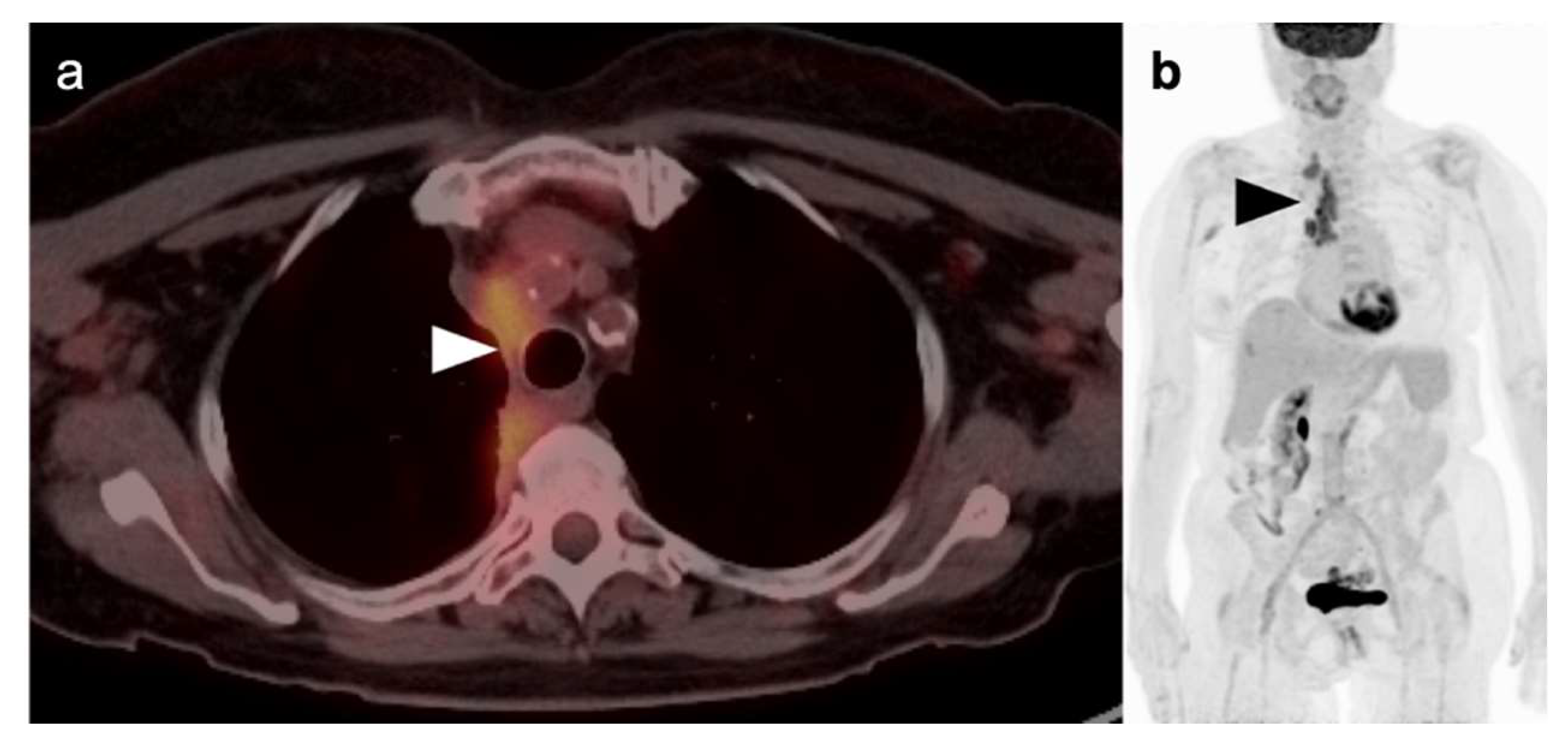 Cancers 14 02689 g011 Cancers 14 02689 g011