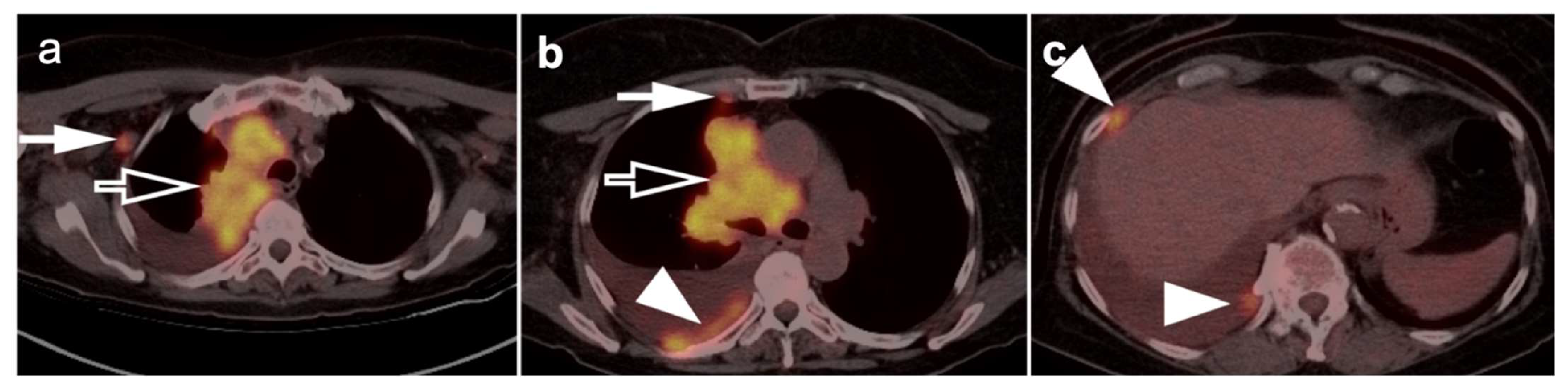 Cancers 14 02689 g012 Cancers 14 02689 g012