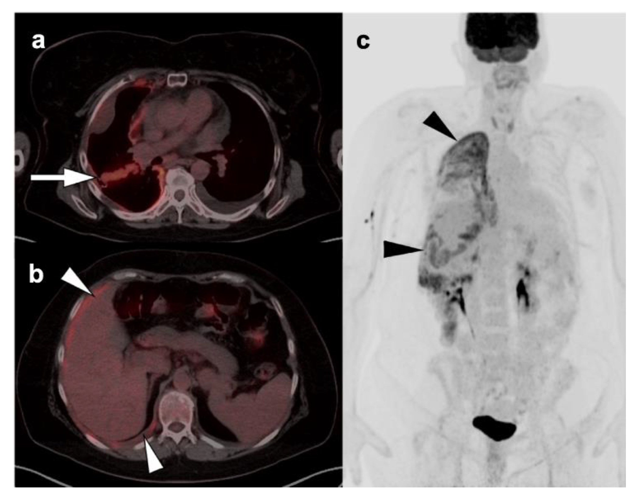 Cancers 14 02689 g013 Cancers 14 02689 g013