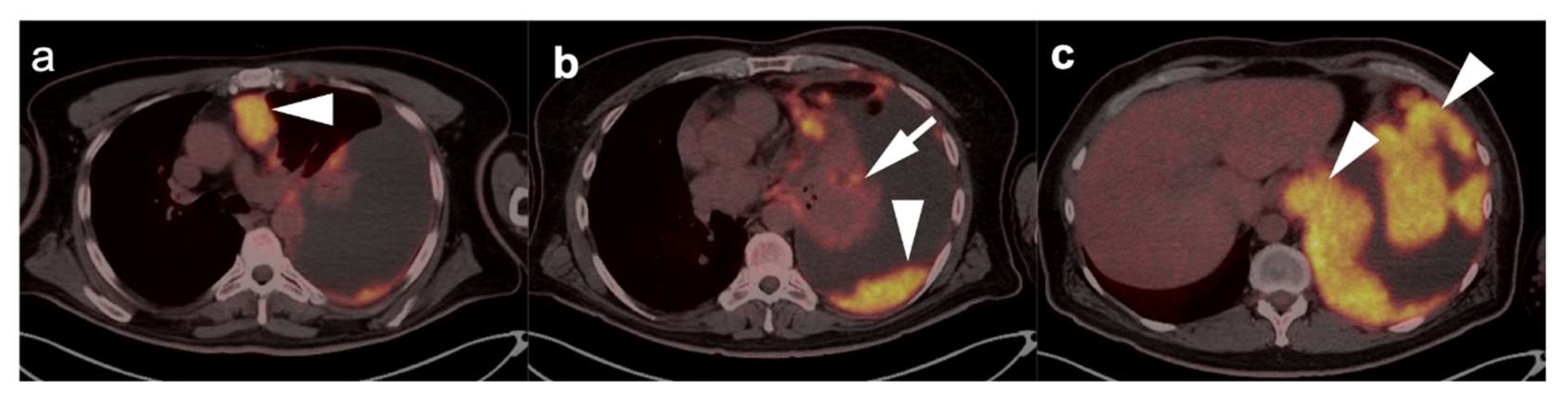 Cancers 14 02689 g014 Cancers 14 02689 g014