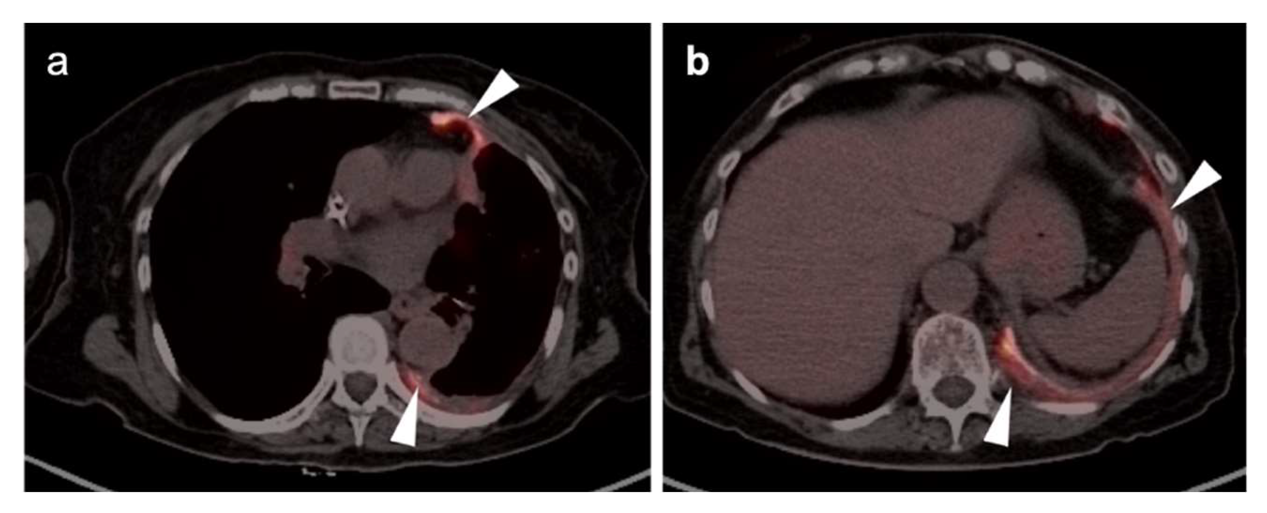 Cancers 14 02689 g015 Cancers 14 02689 g015
