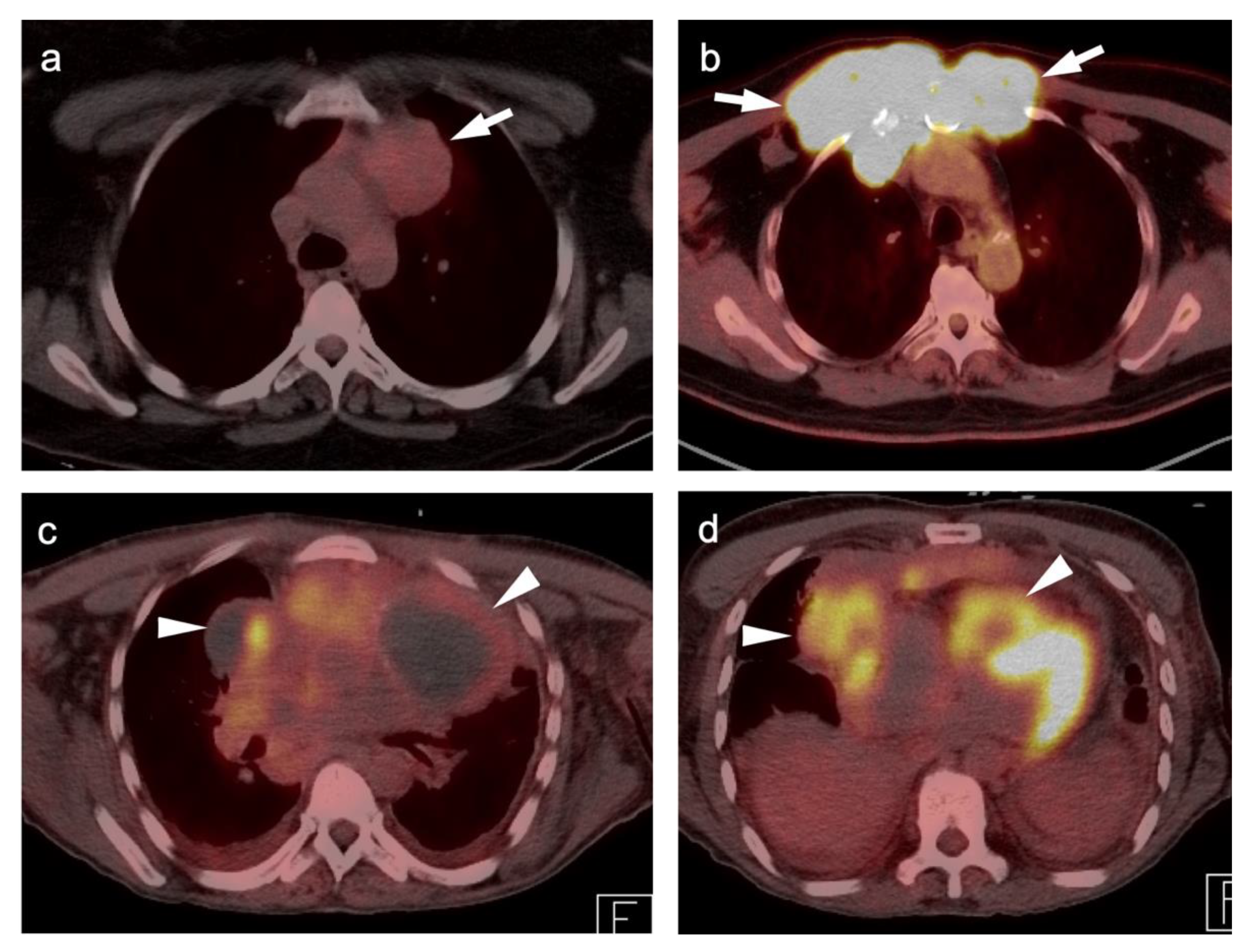 Cancers 14 02689 g016 Cancers 14 02689 g016