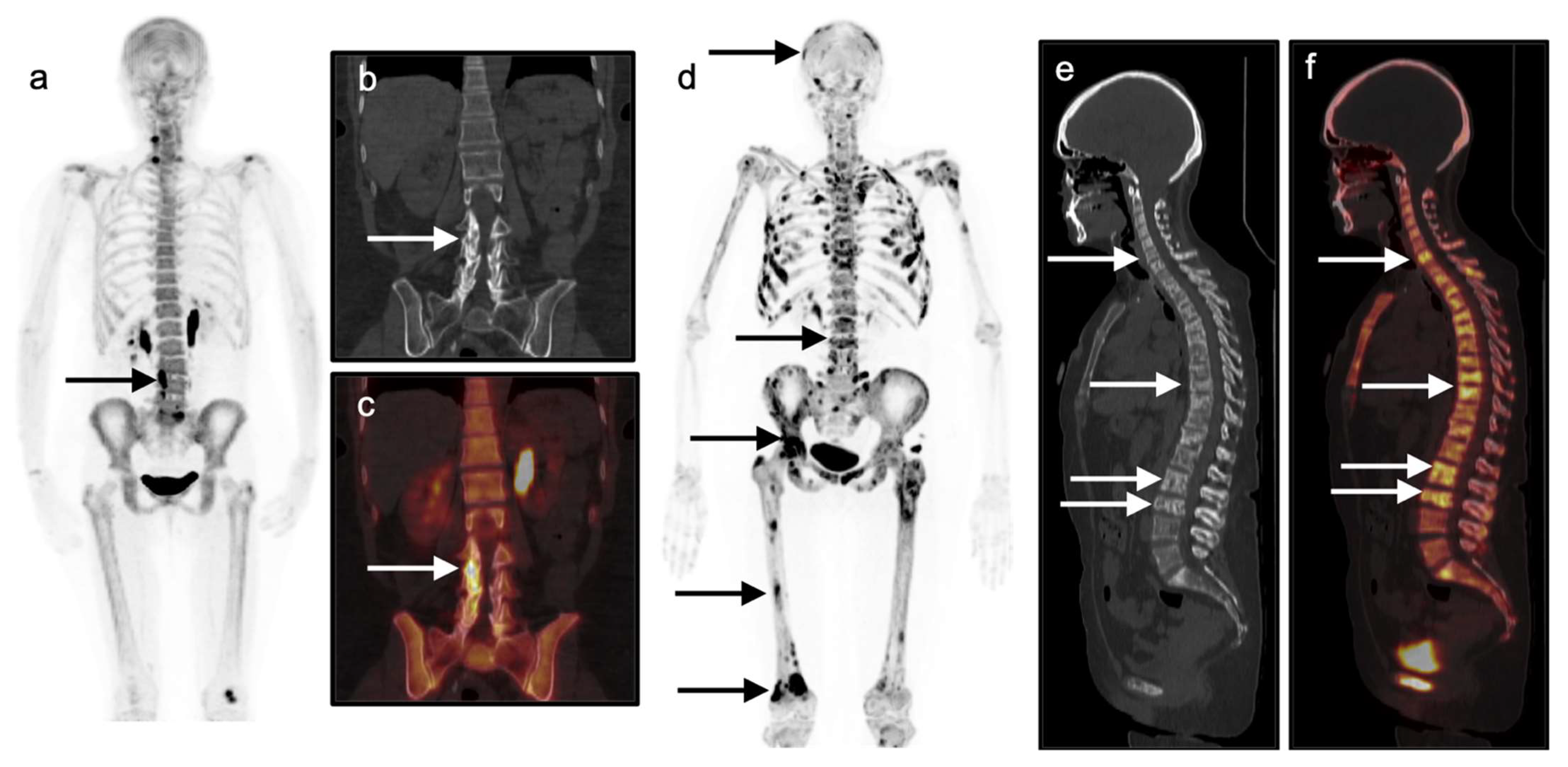 Cancers 14 02689 g019 Cancers 14 02689 g019