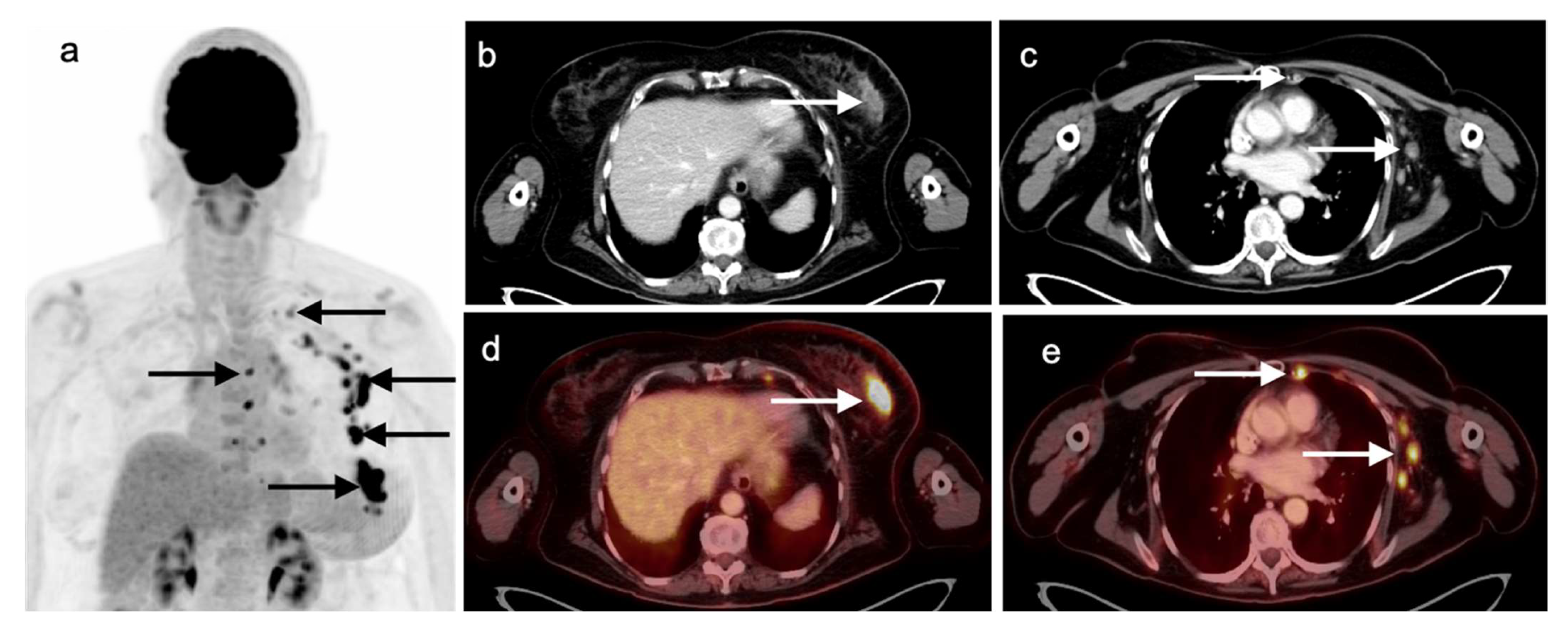 Cancers 14 02689 g020 Cancers 14 02689 g020