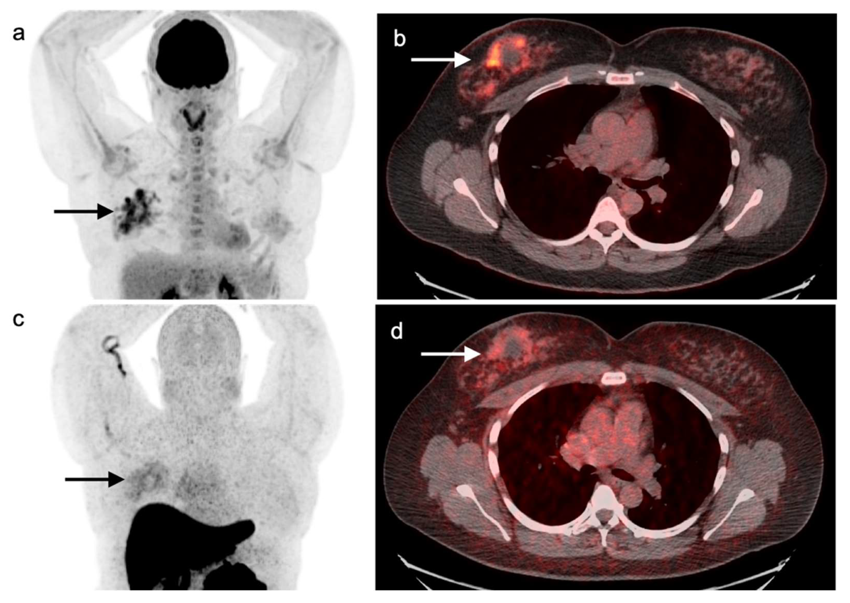 Cancers 14 02689 g021 Cancers 14 02689 g021