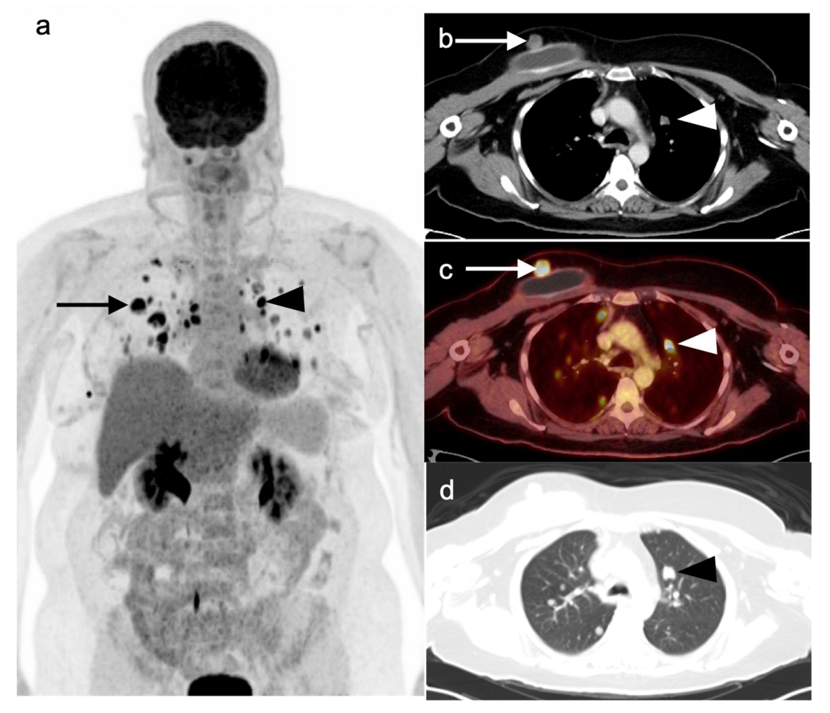 Cancers 14 02689 g022 Cancers 14 02689 g022