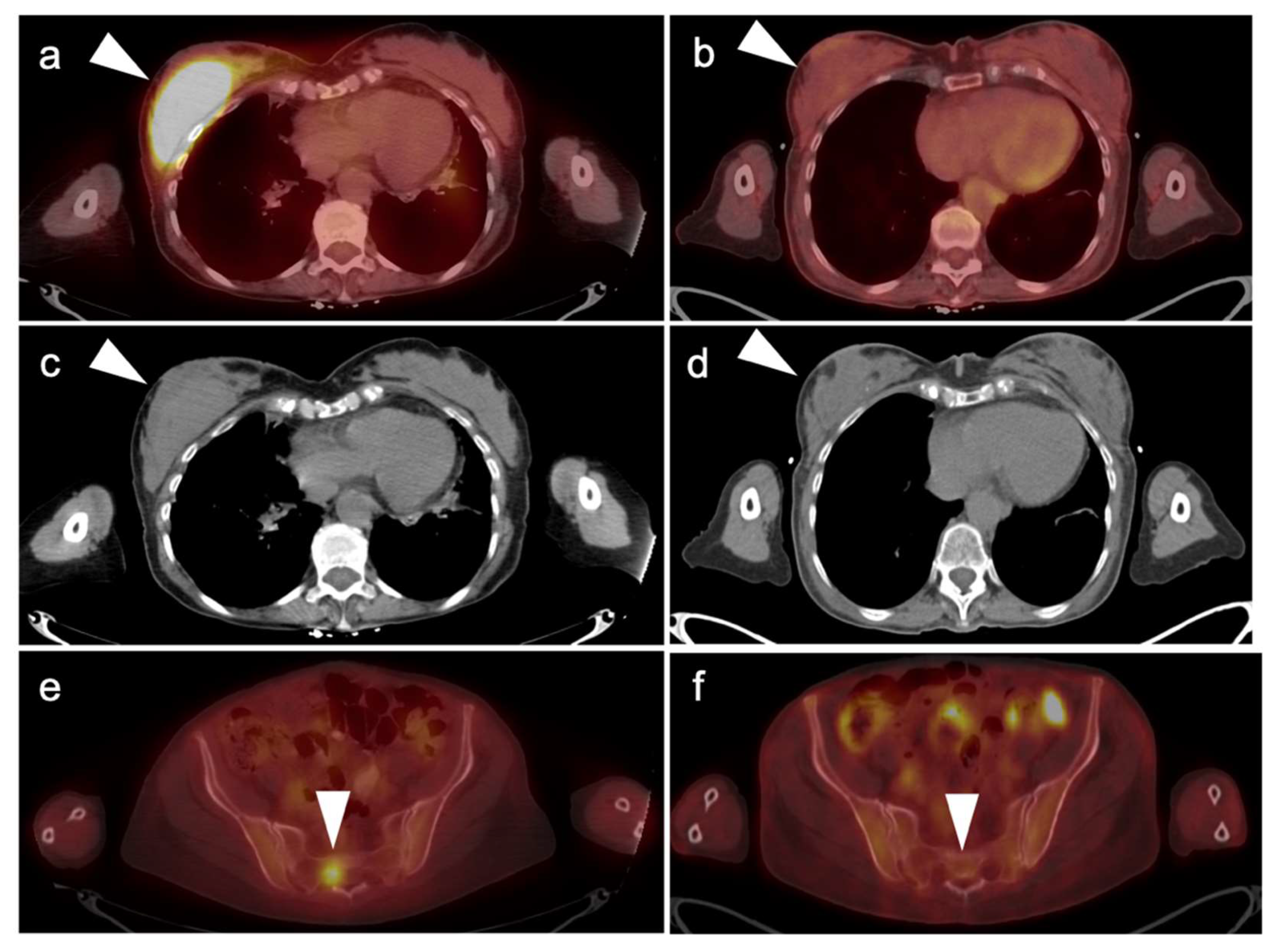 Cancers 14 02689 g023 Cancers 14 02689 g023