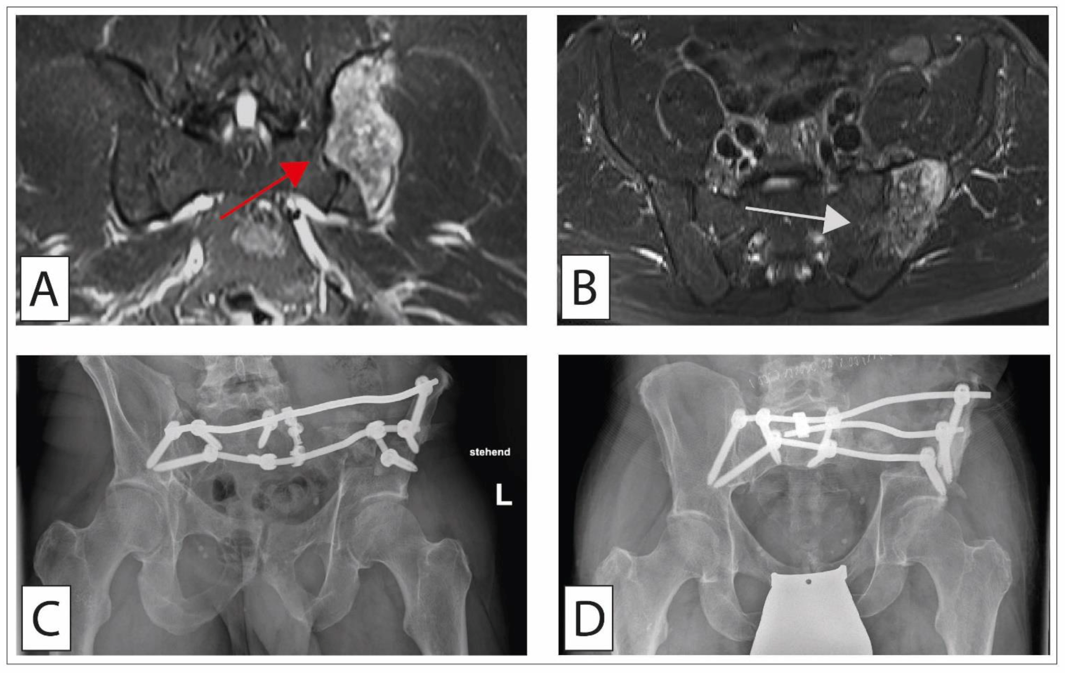 Cancers 14 02694 g005 Cancers 14 02694 g005