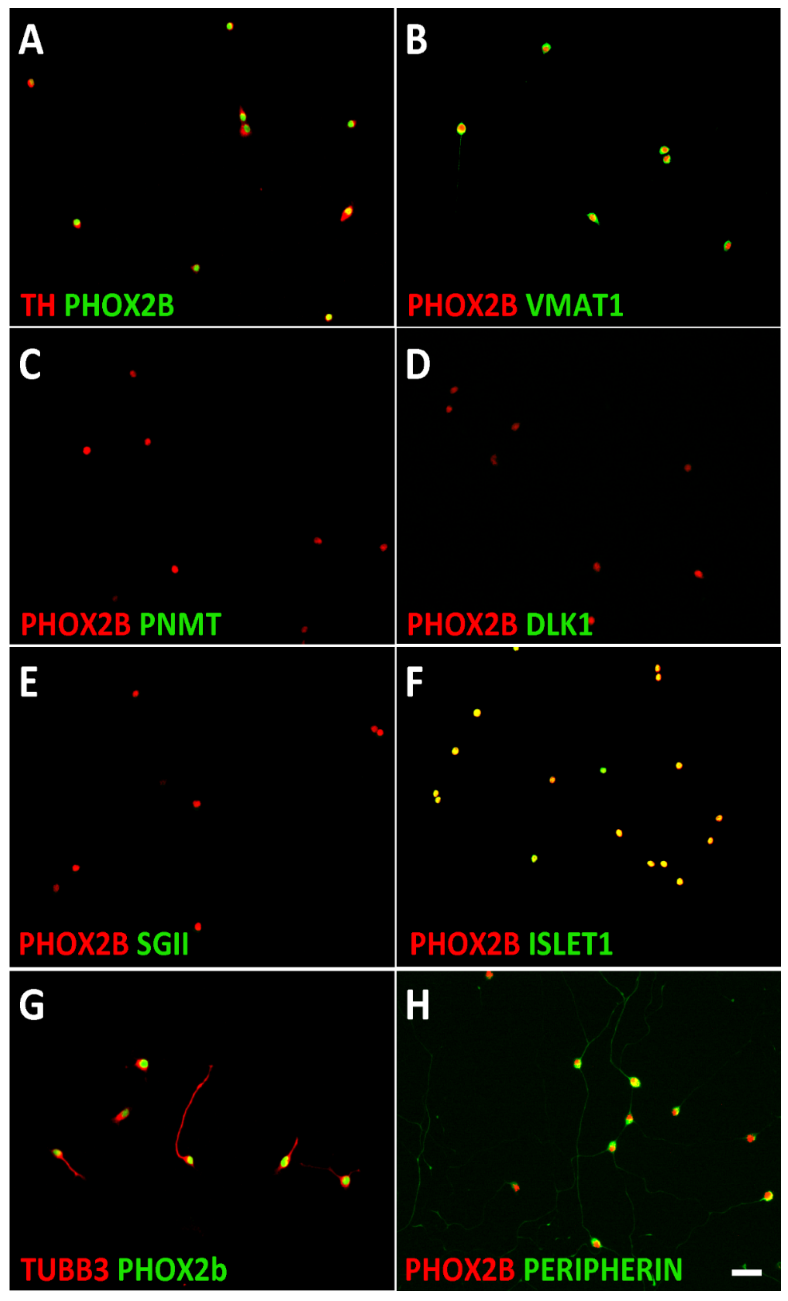 X Family 68 Tk - Cancers | Free Full-Text | BET and CDK Inhibition Reveal Differences in the  Proliferation Control of Sympathetic Ganglion Neuroblasts and Adrenal  Chromaffin Cells