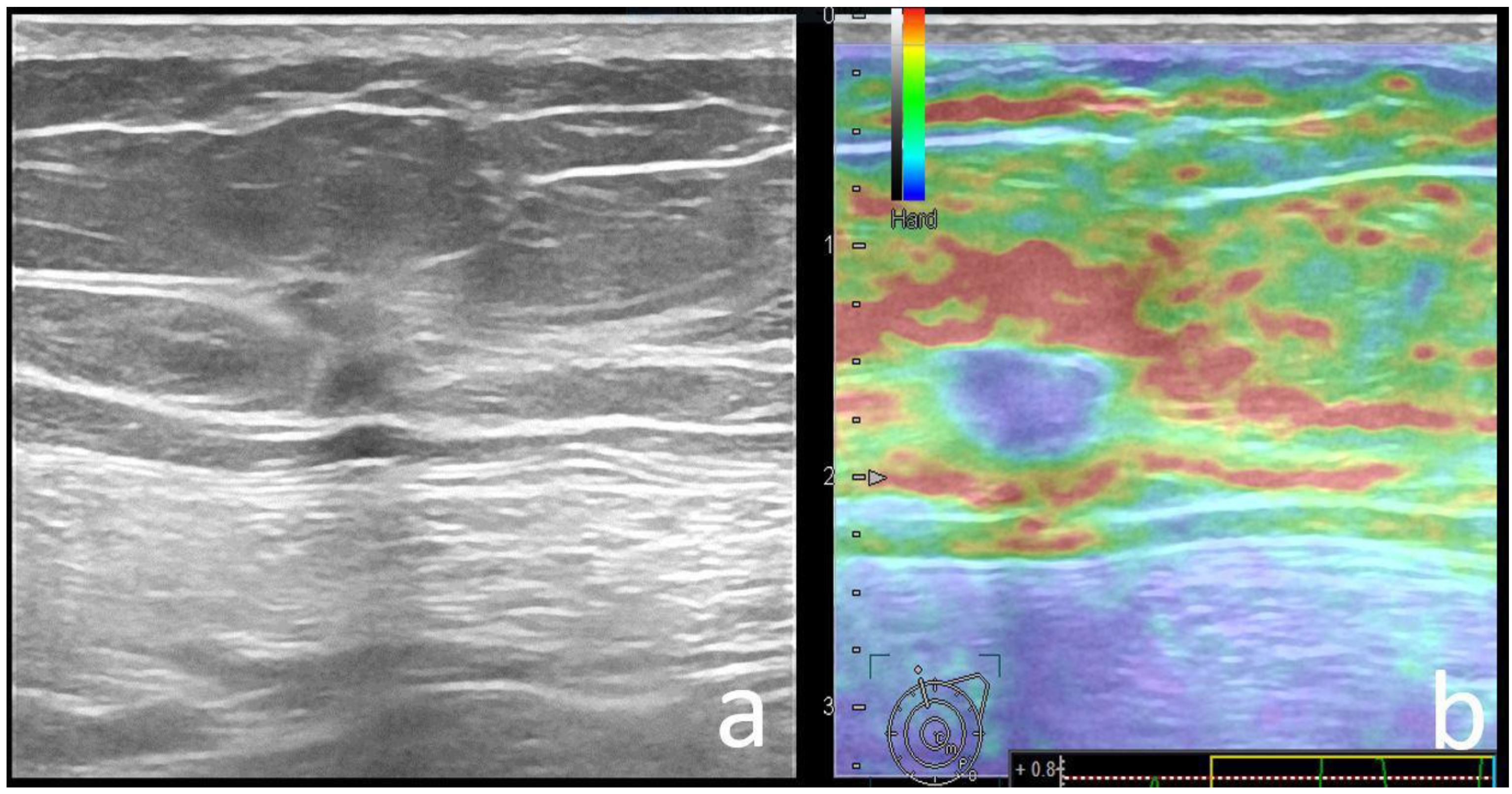 Cancers 14 02759 g002