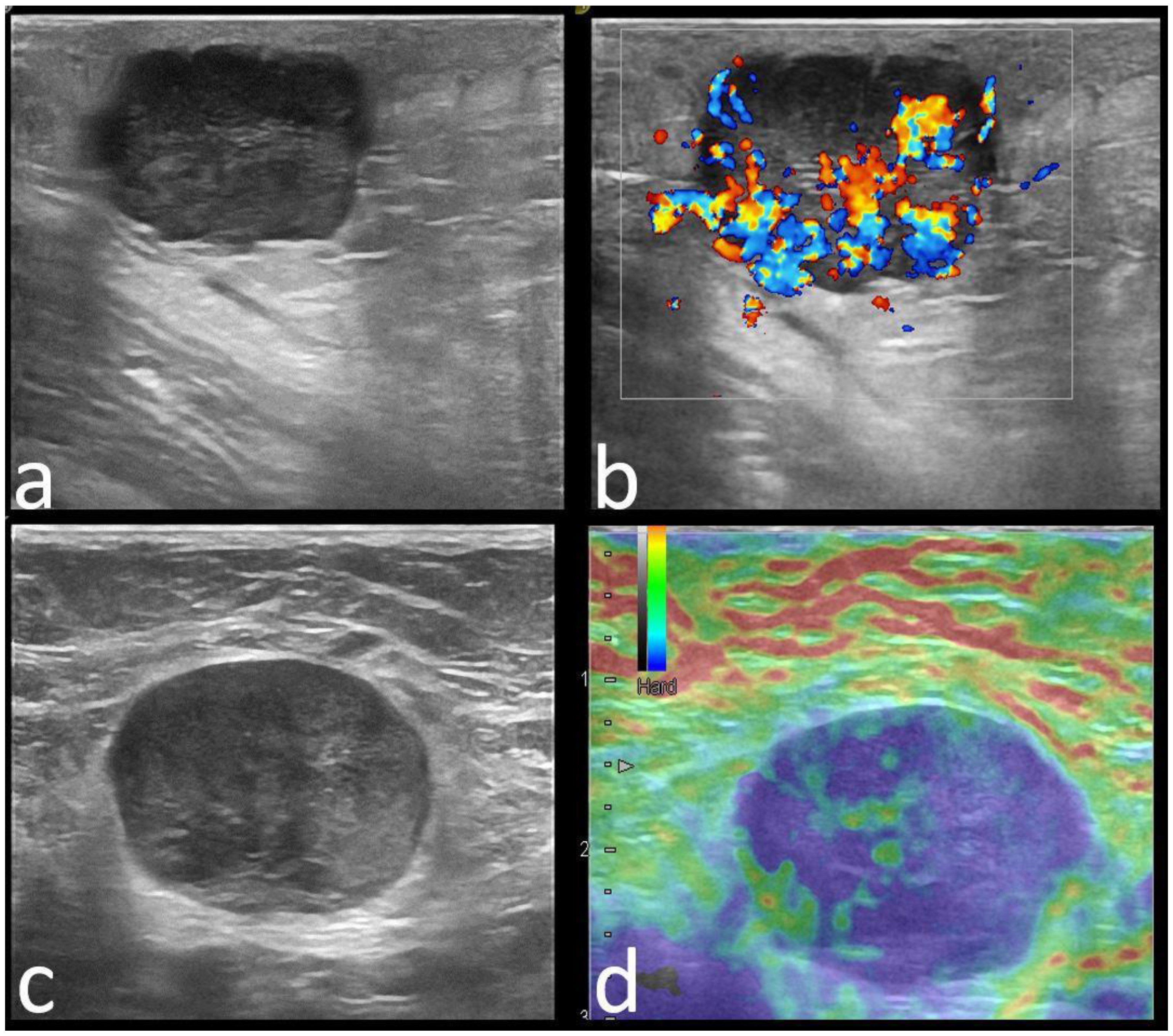 Cancers 14 02759 g003