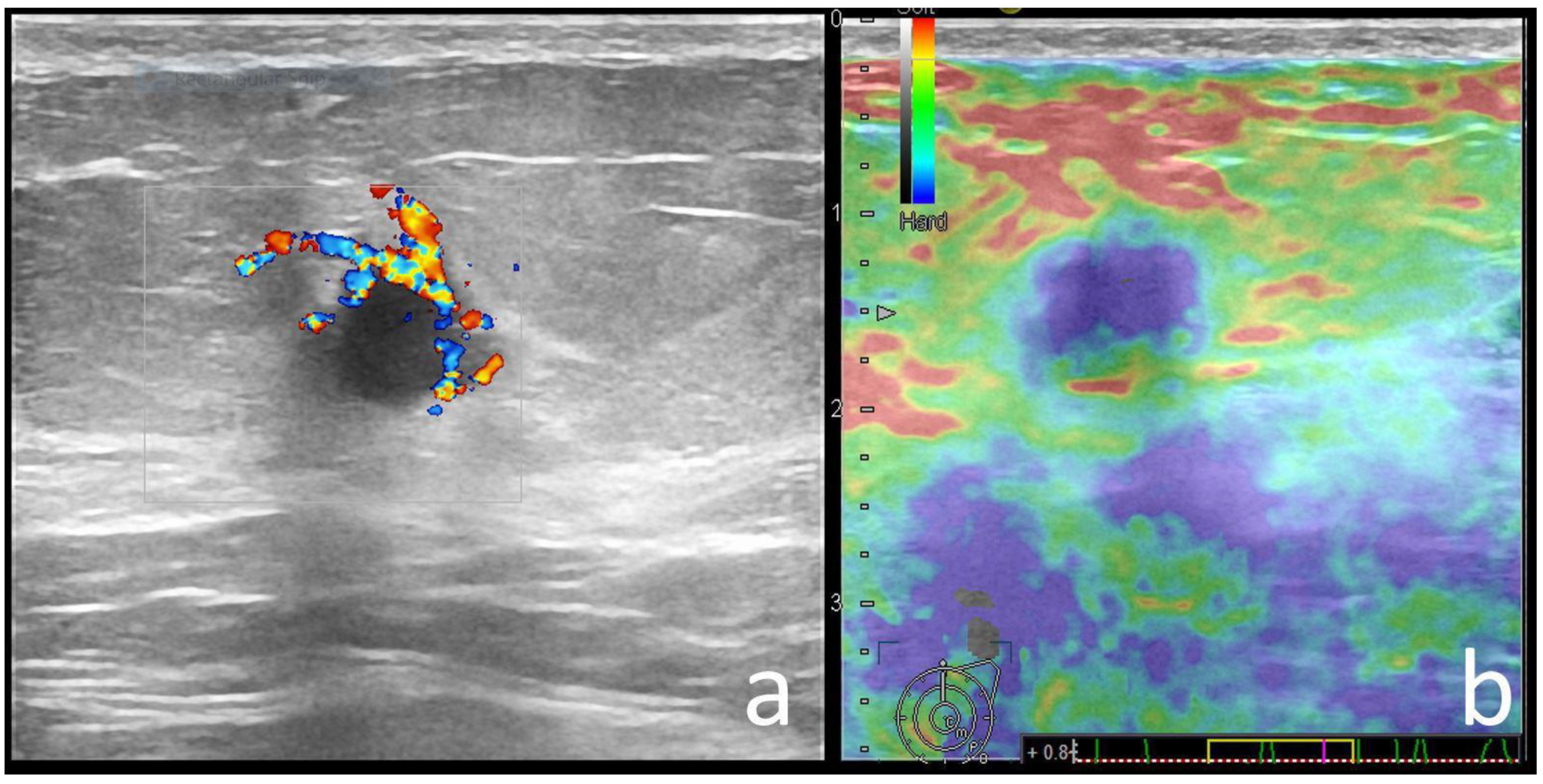 Cancers 14 02759 g006