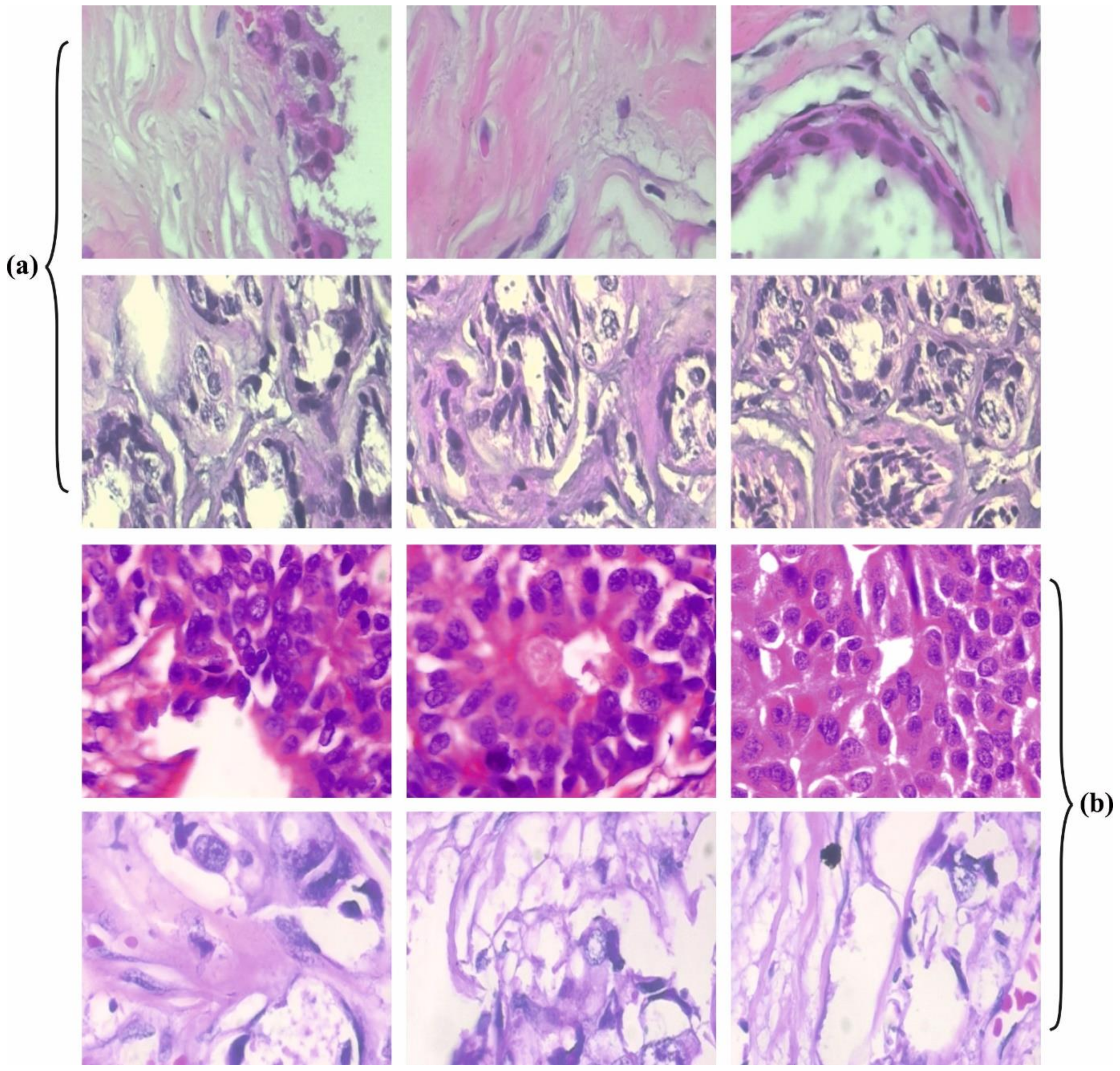 Cancers 14 02770 g003