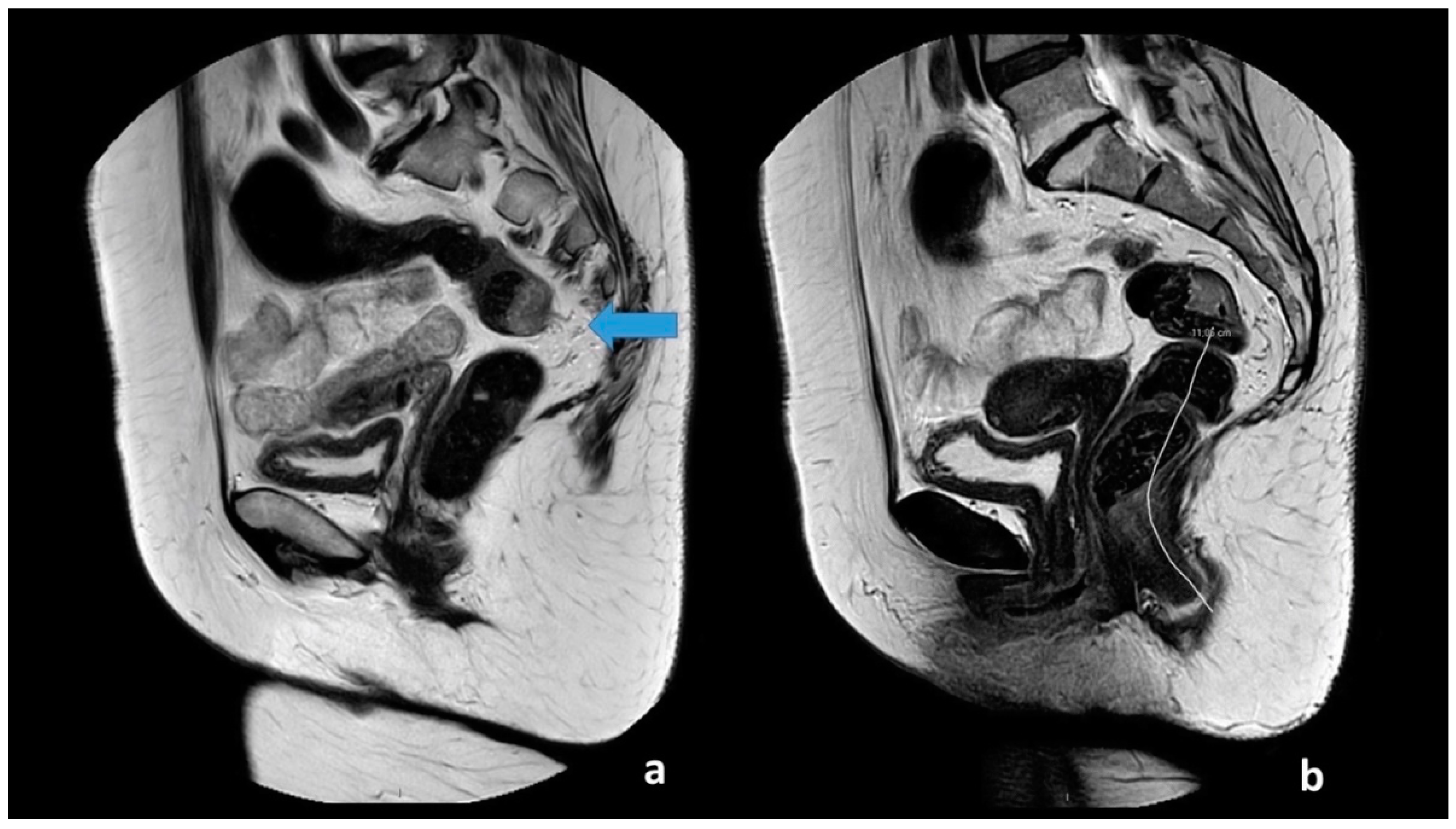 Cancers 14 02802 g001 550