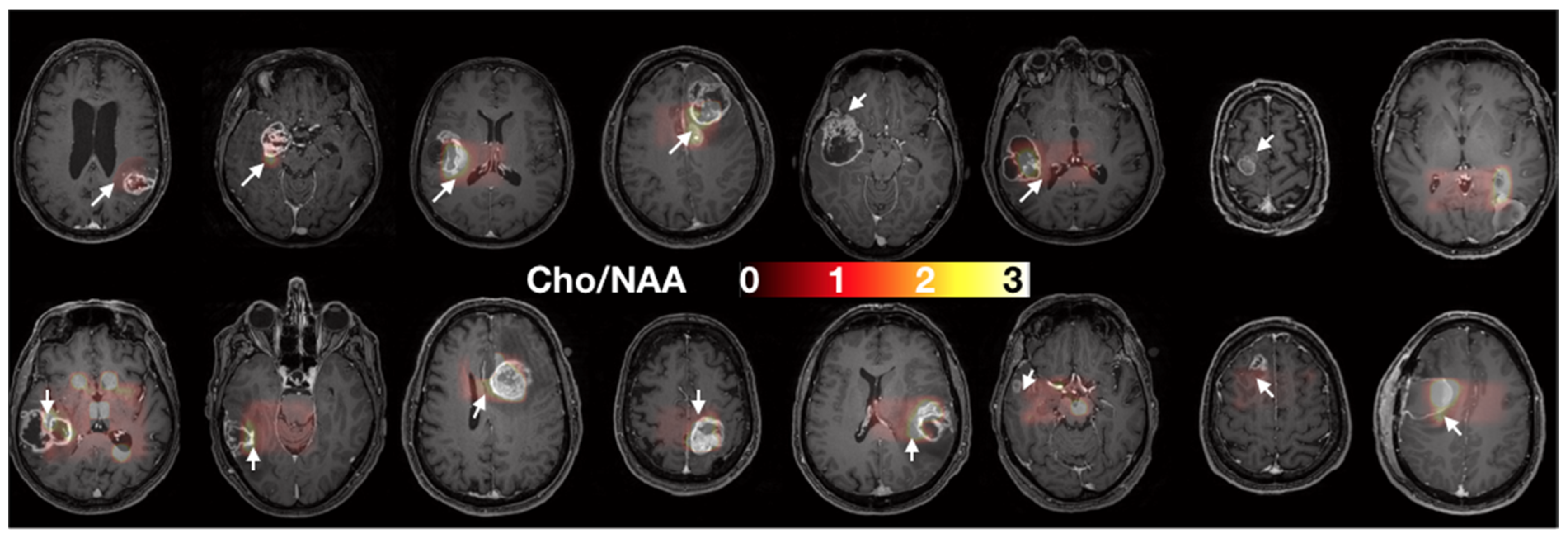 Cancers 14 02803 g002