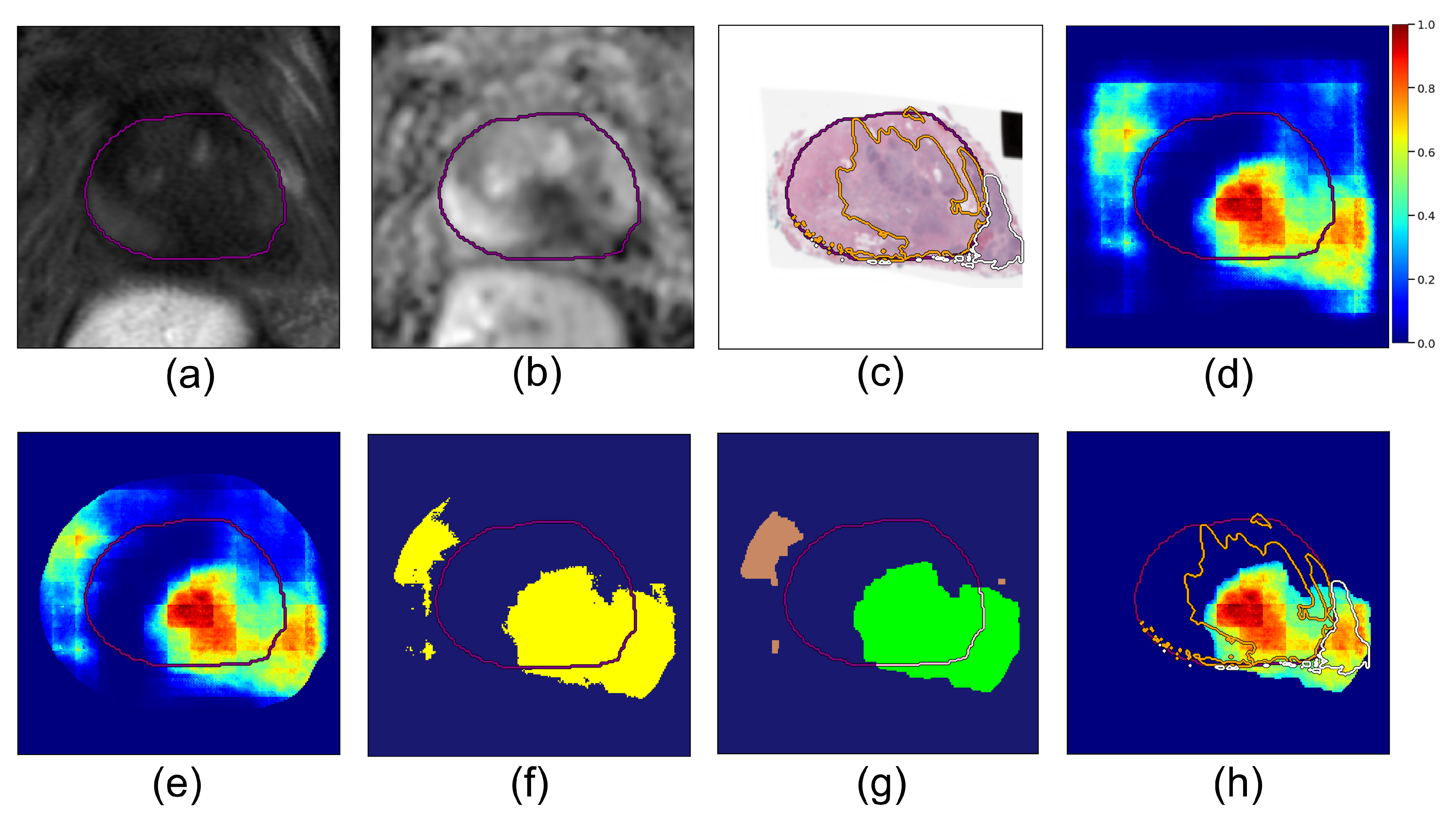 Cancers 14 02821 g002