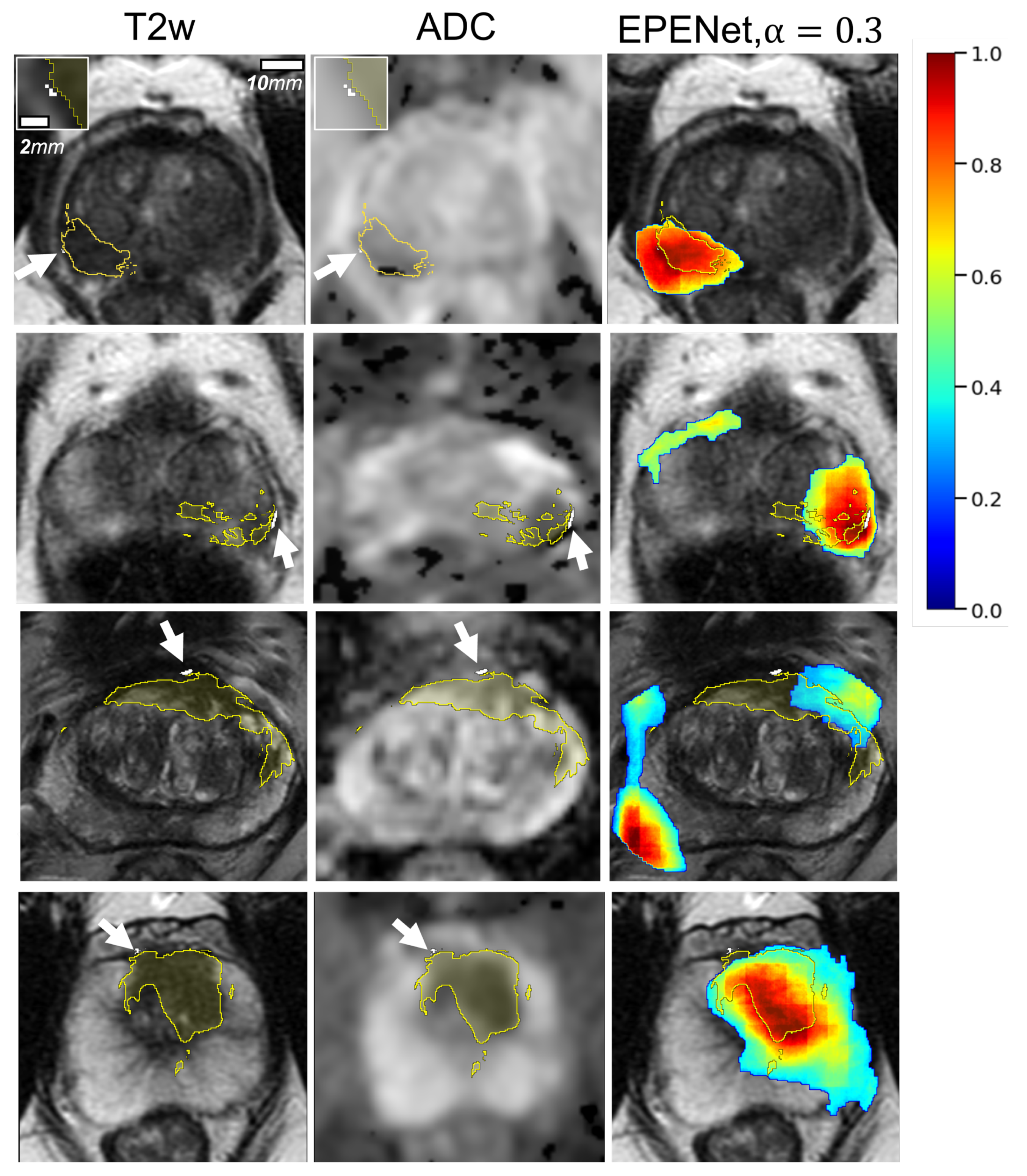 Cancers 14 02821 g0a1