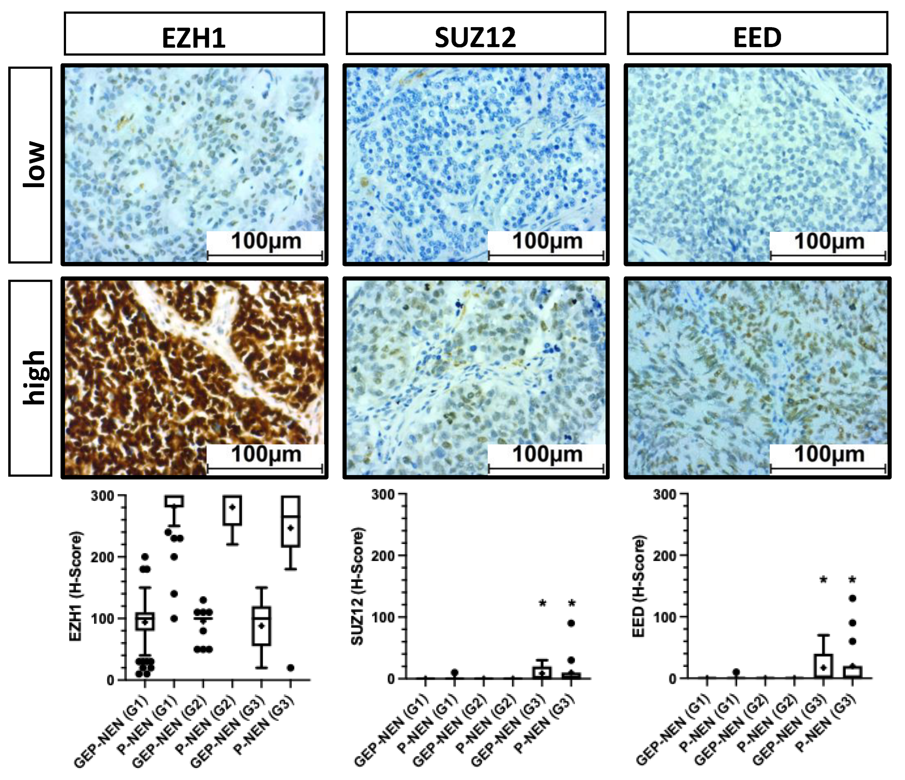 Cancers 14 02828 g005