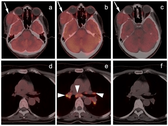 健康・医学 PET in Clinical Oncology PET Molecular Imaging: A Holistic Review of Current Practice