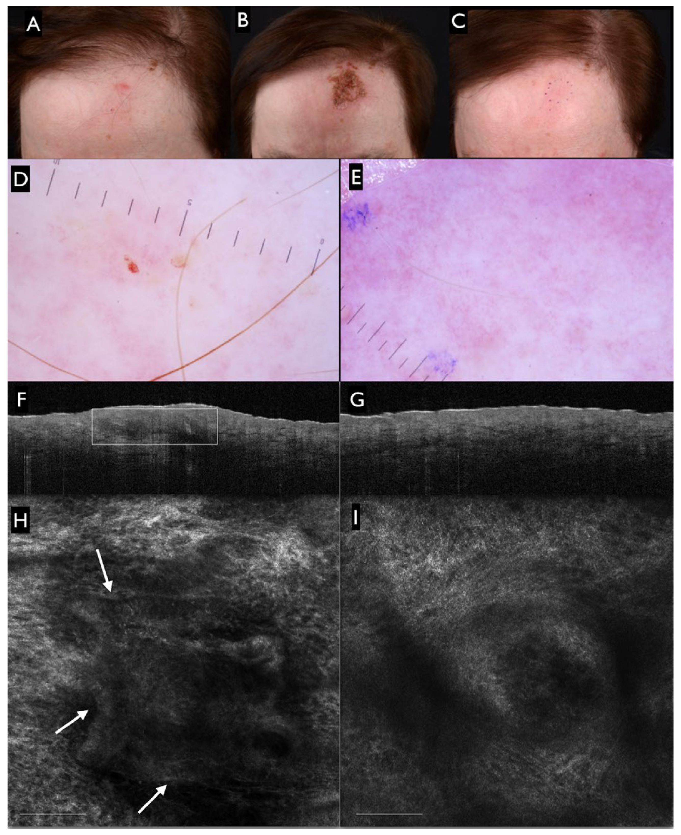 Cancers 14 02836 g004 550