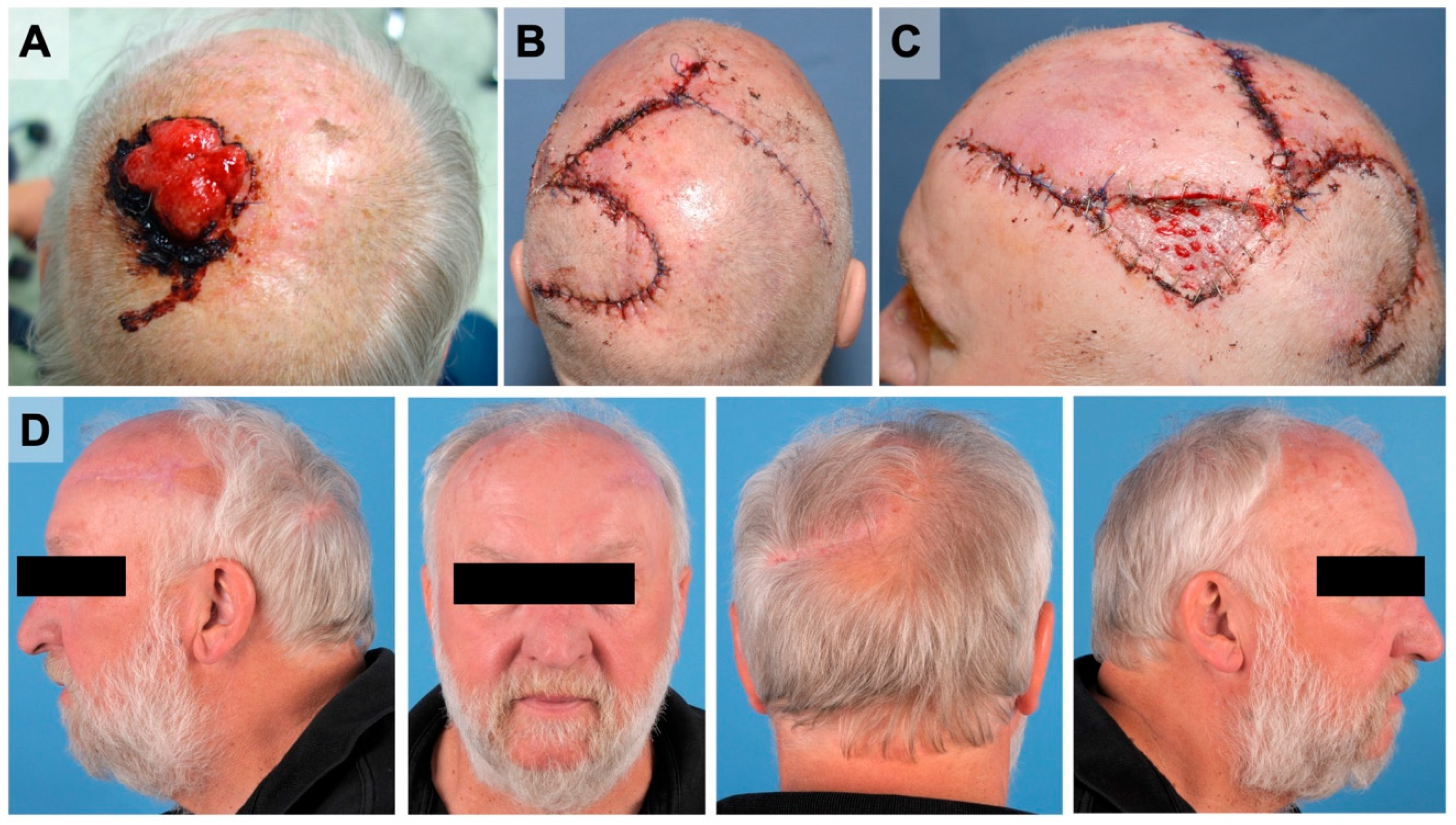 Cancers 14 02869 g002 550