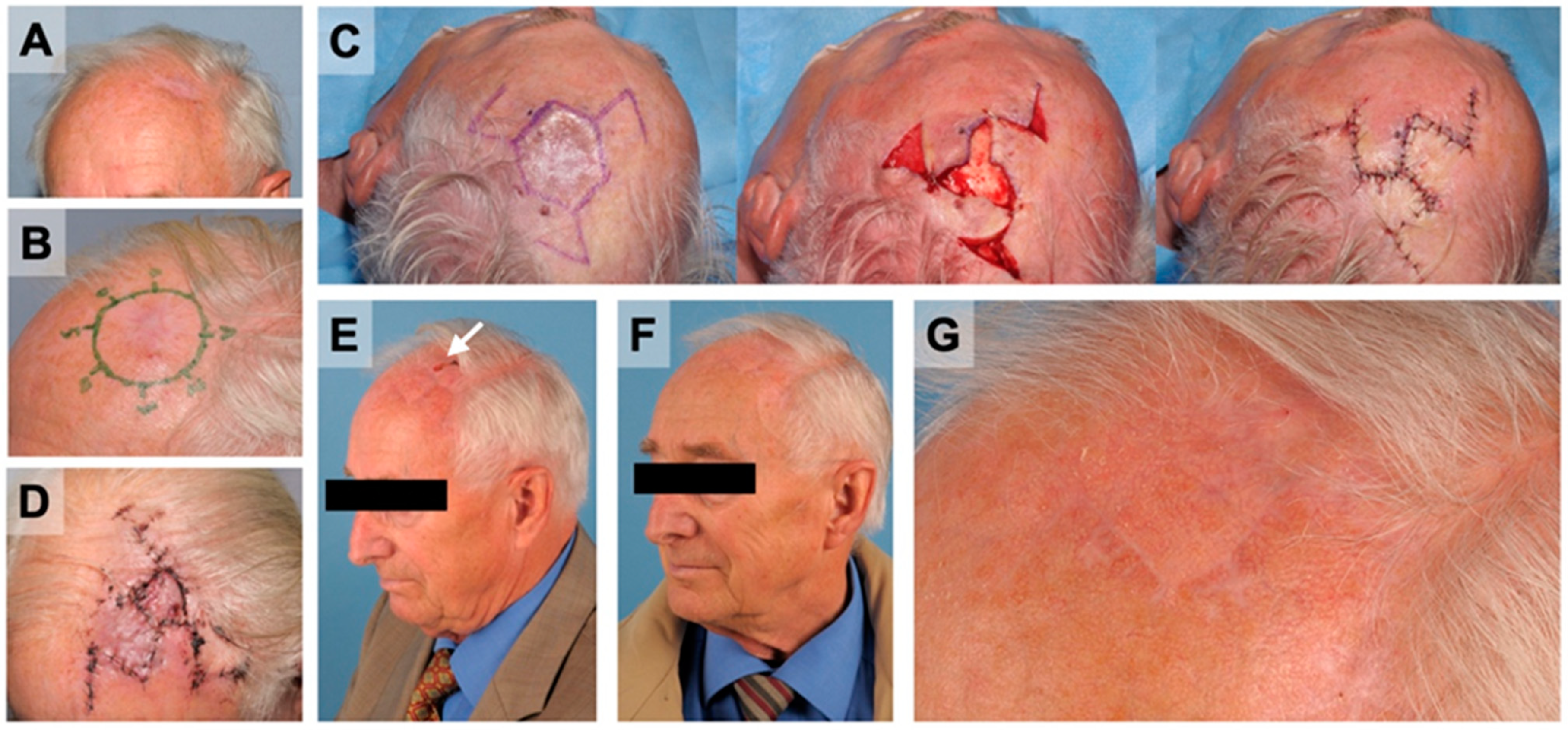 Cancers 14 02869 g003 550