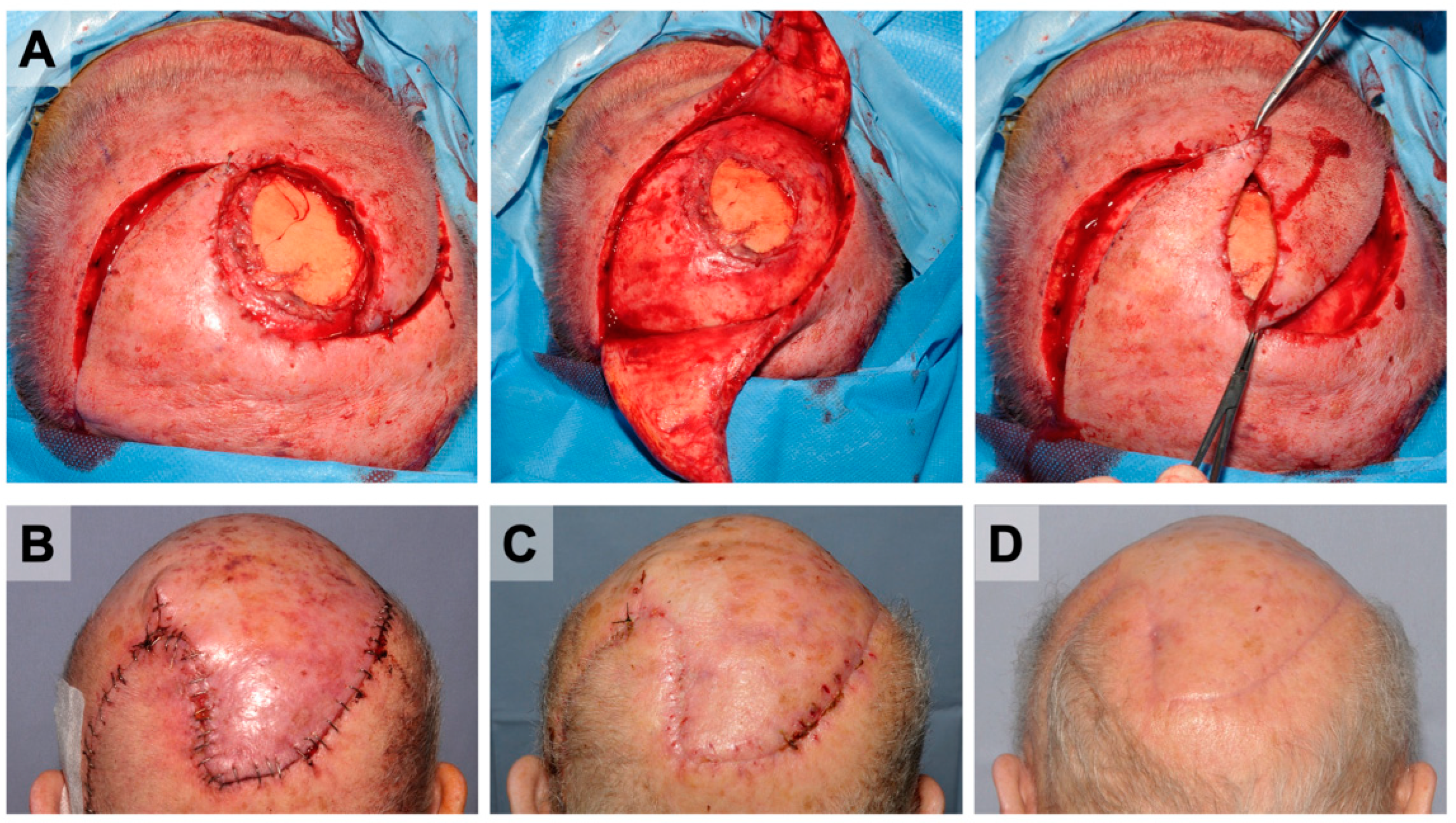 Cancers 14 02869 g004 550