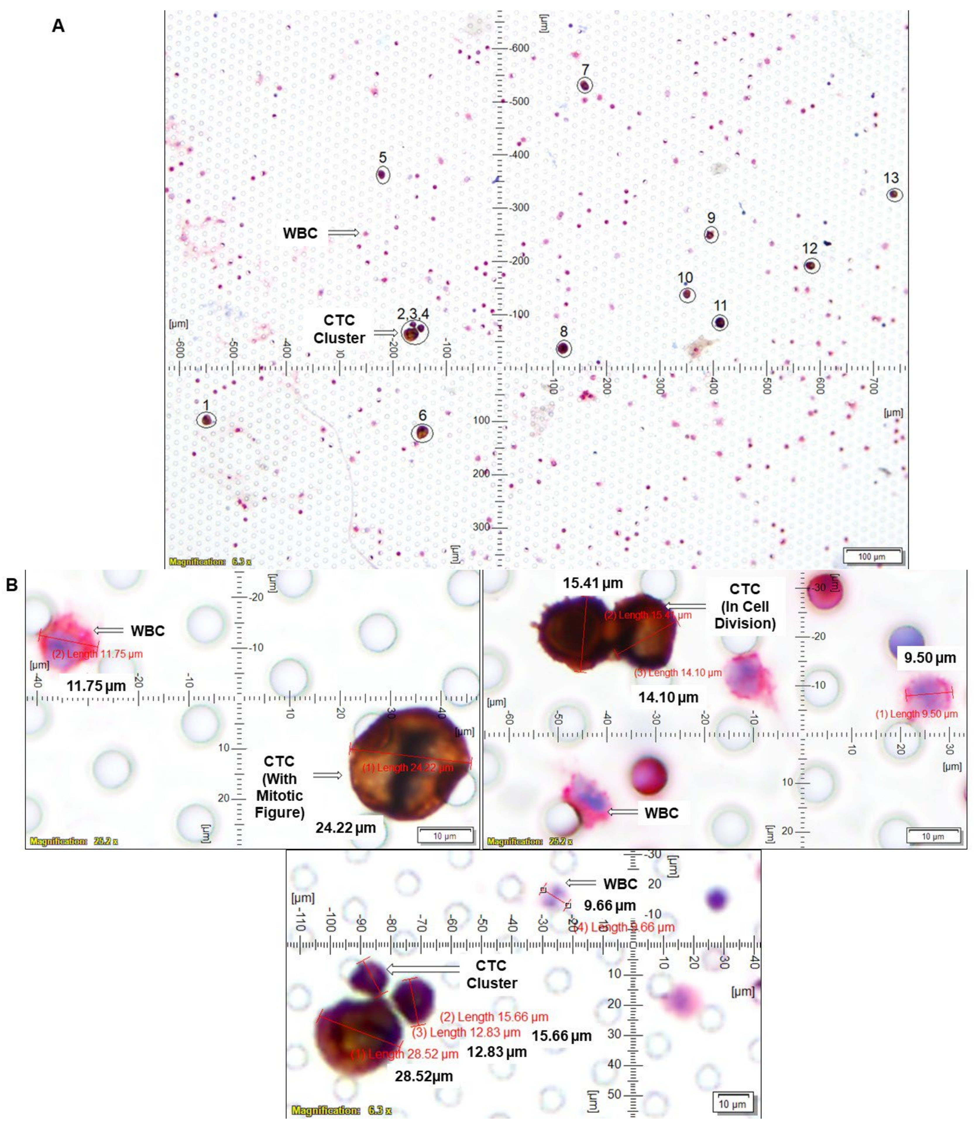 Cancers 14 02871 g005