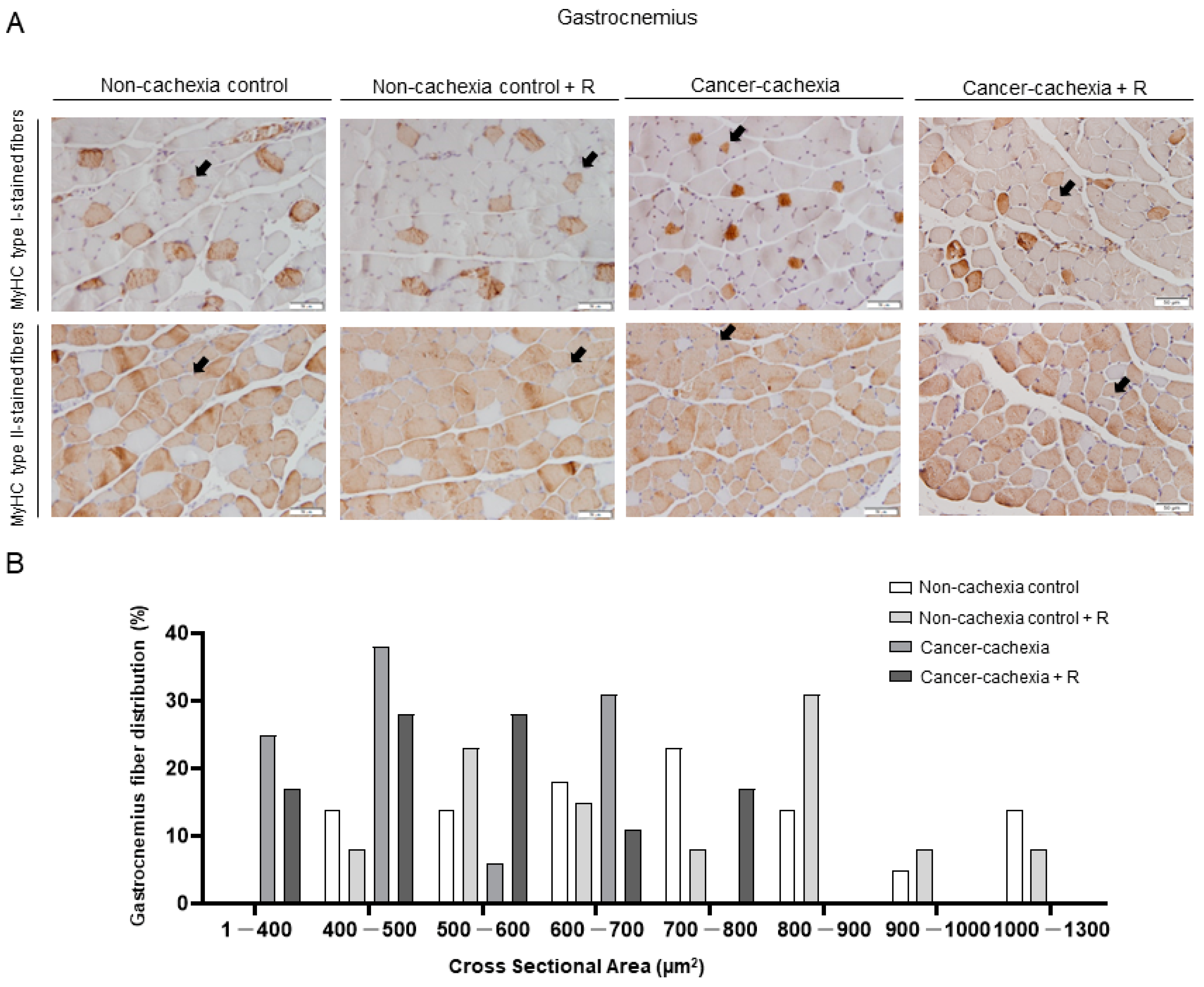 Cancers 14 02894 g004 Cancers 14 02894 g004