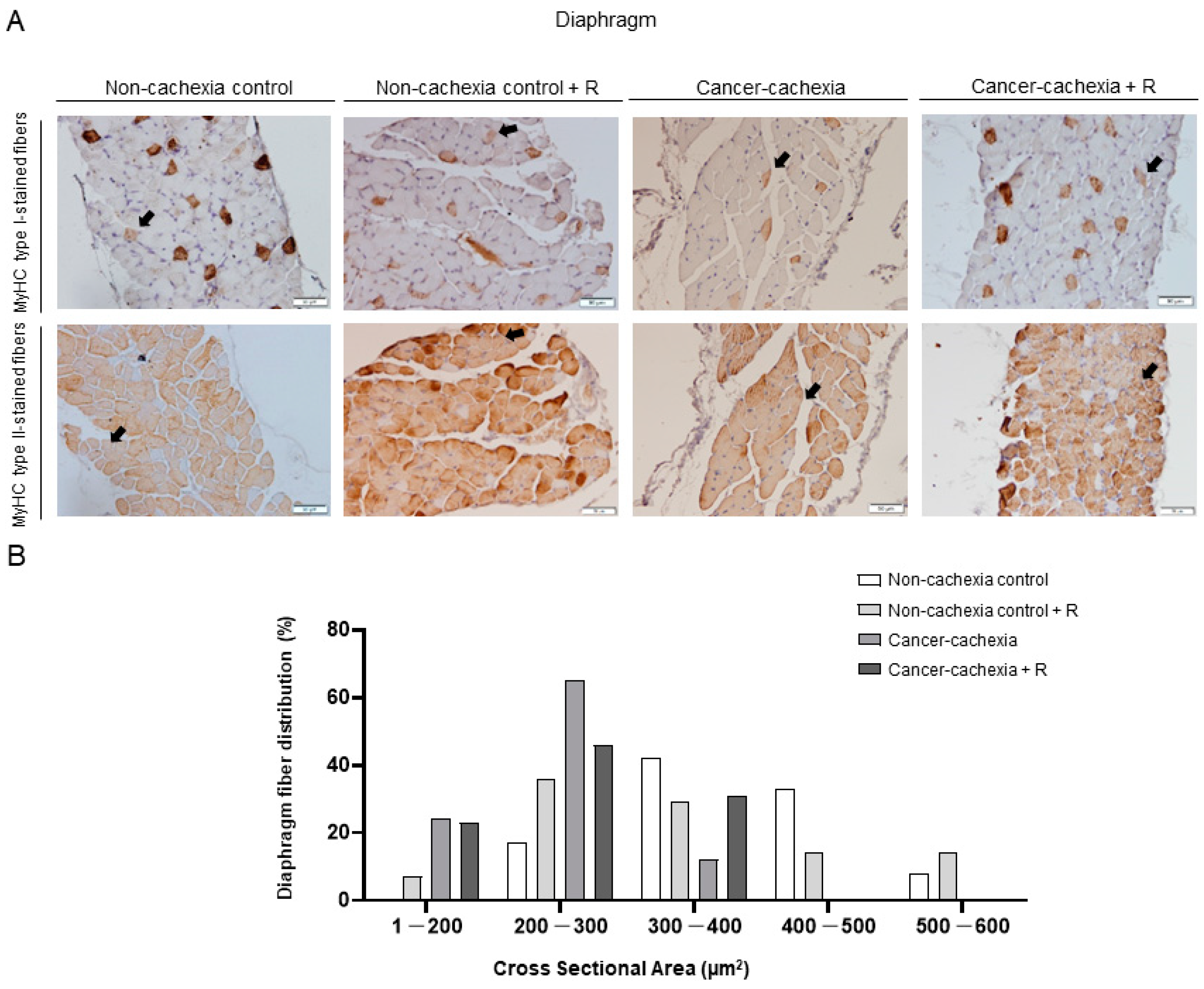 Cancers 14 02894 g005 Cancers 14 02894 g005