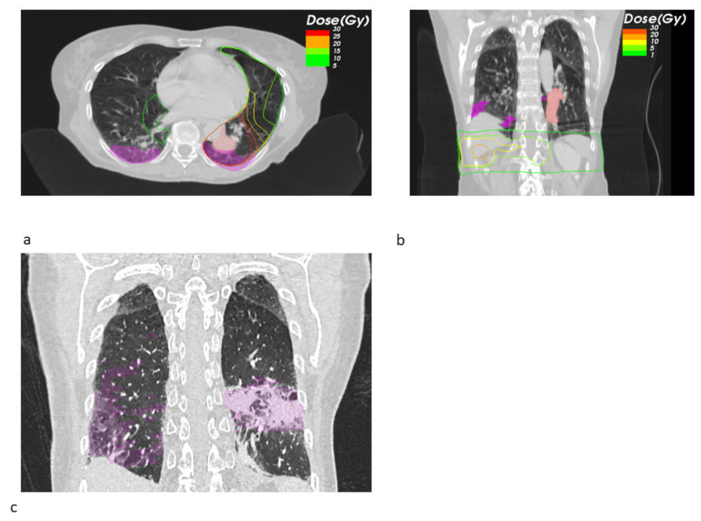 Cancers 14 02948 g002