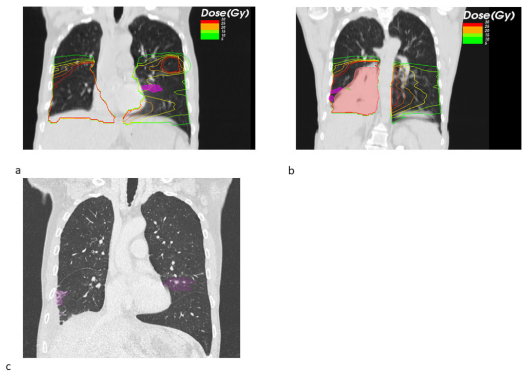 Cancers 14 02948 g003