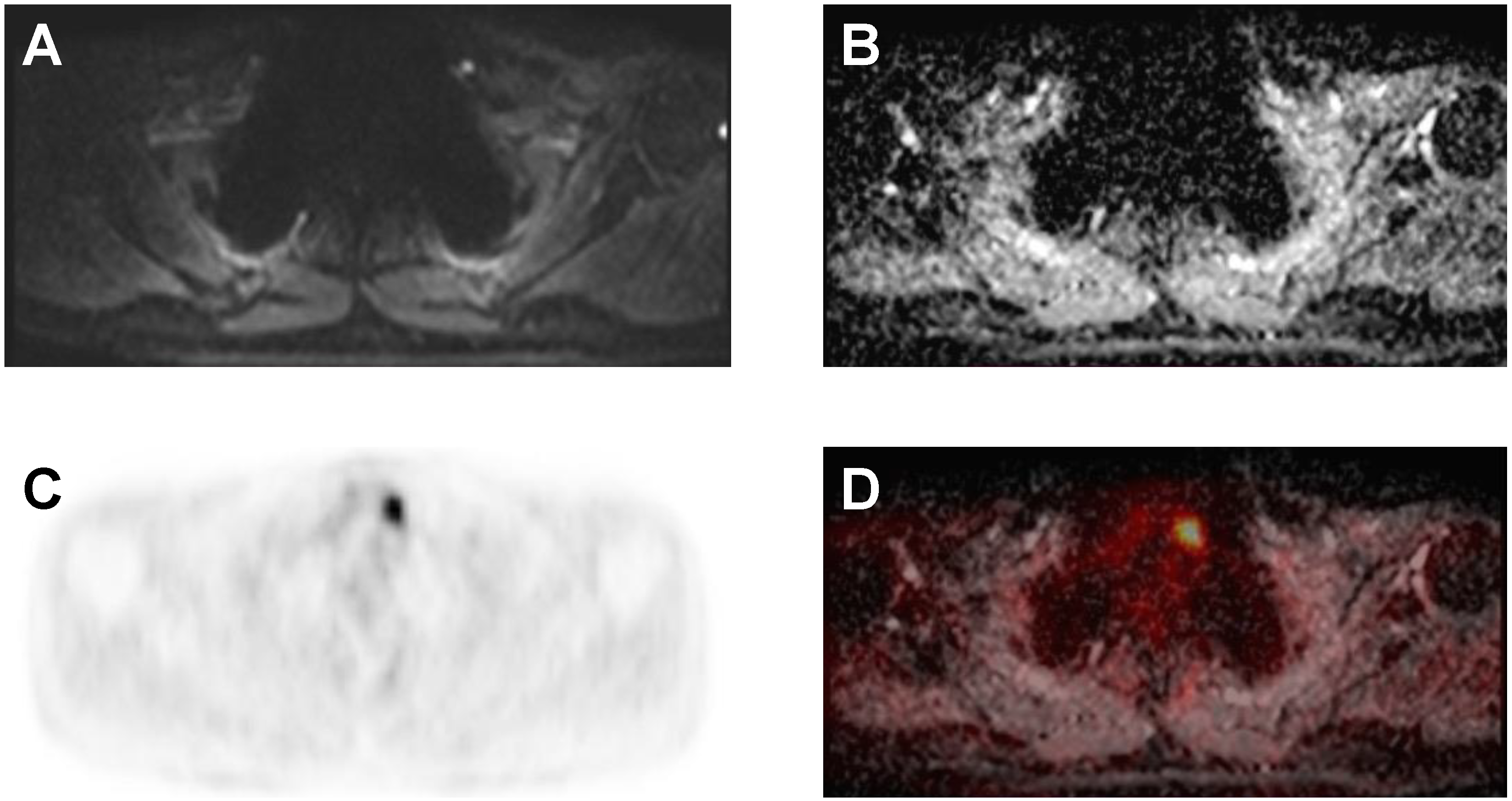 Cancers 14 02958 g004 Cancers 14 02958 g004