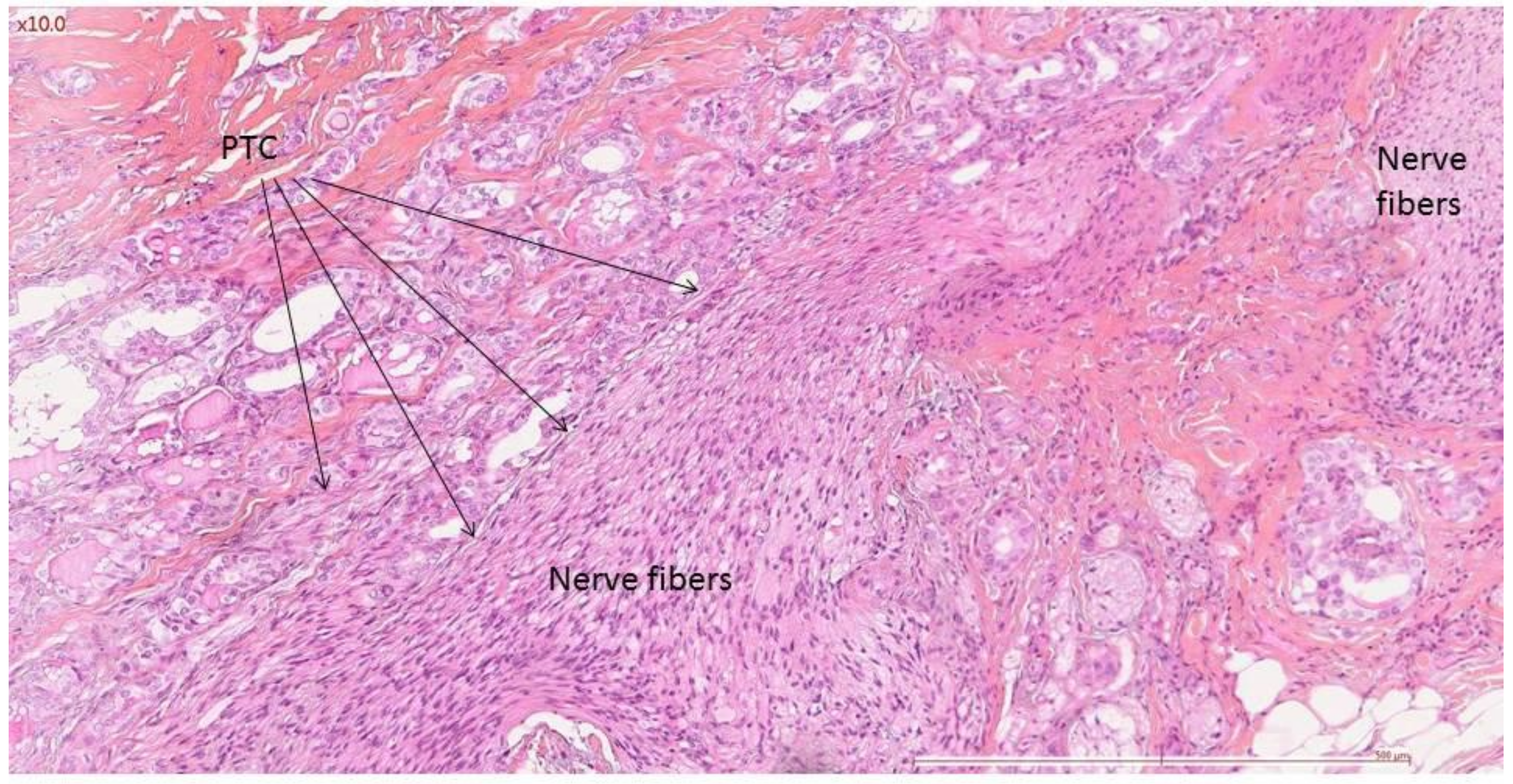 Cancers 14 02961 g001