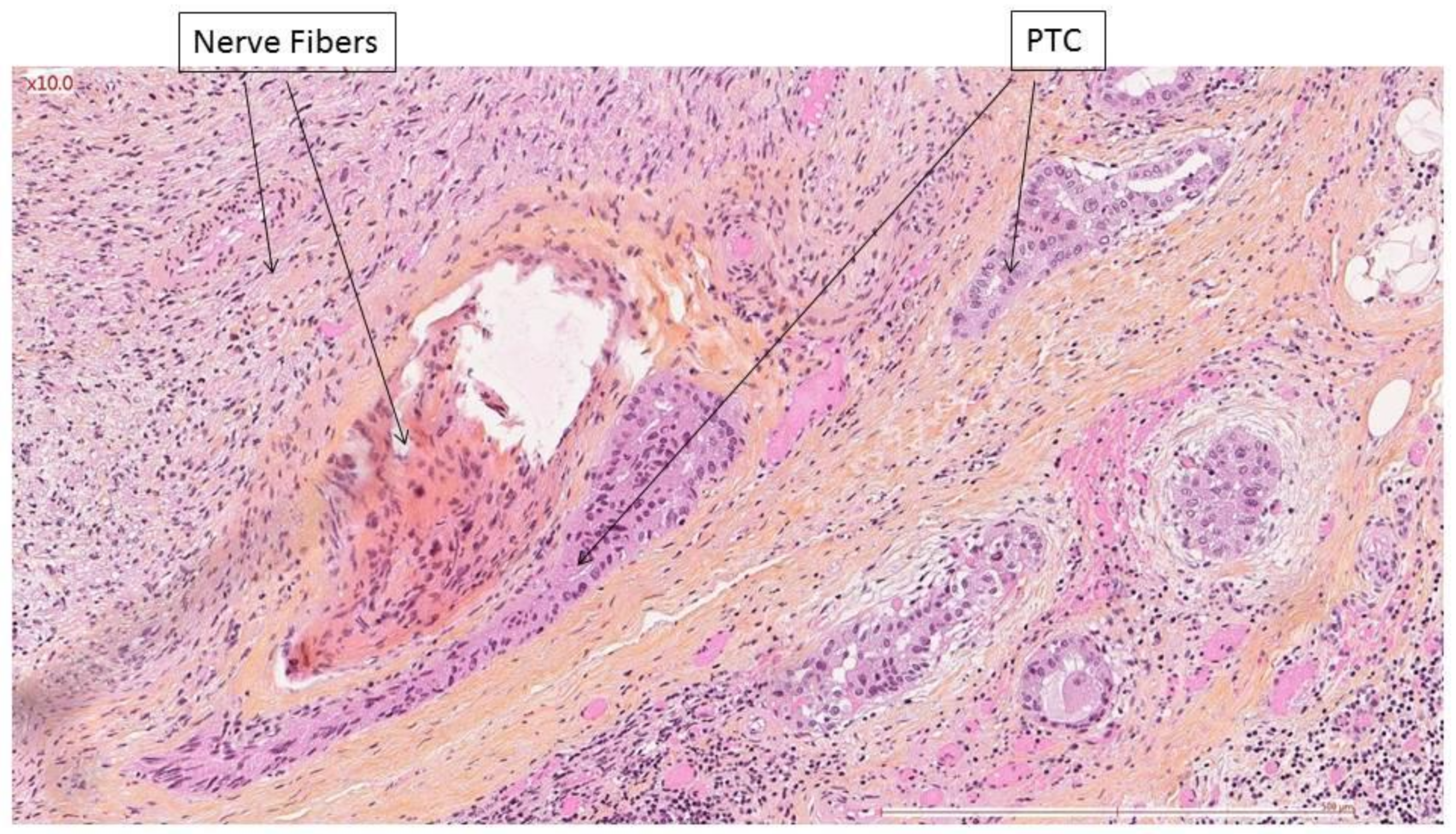 Cancers 14 02961 g002