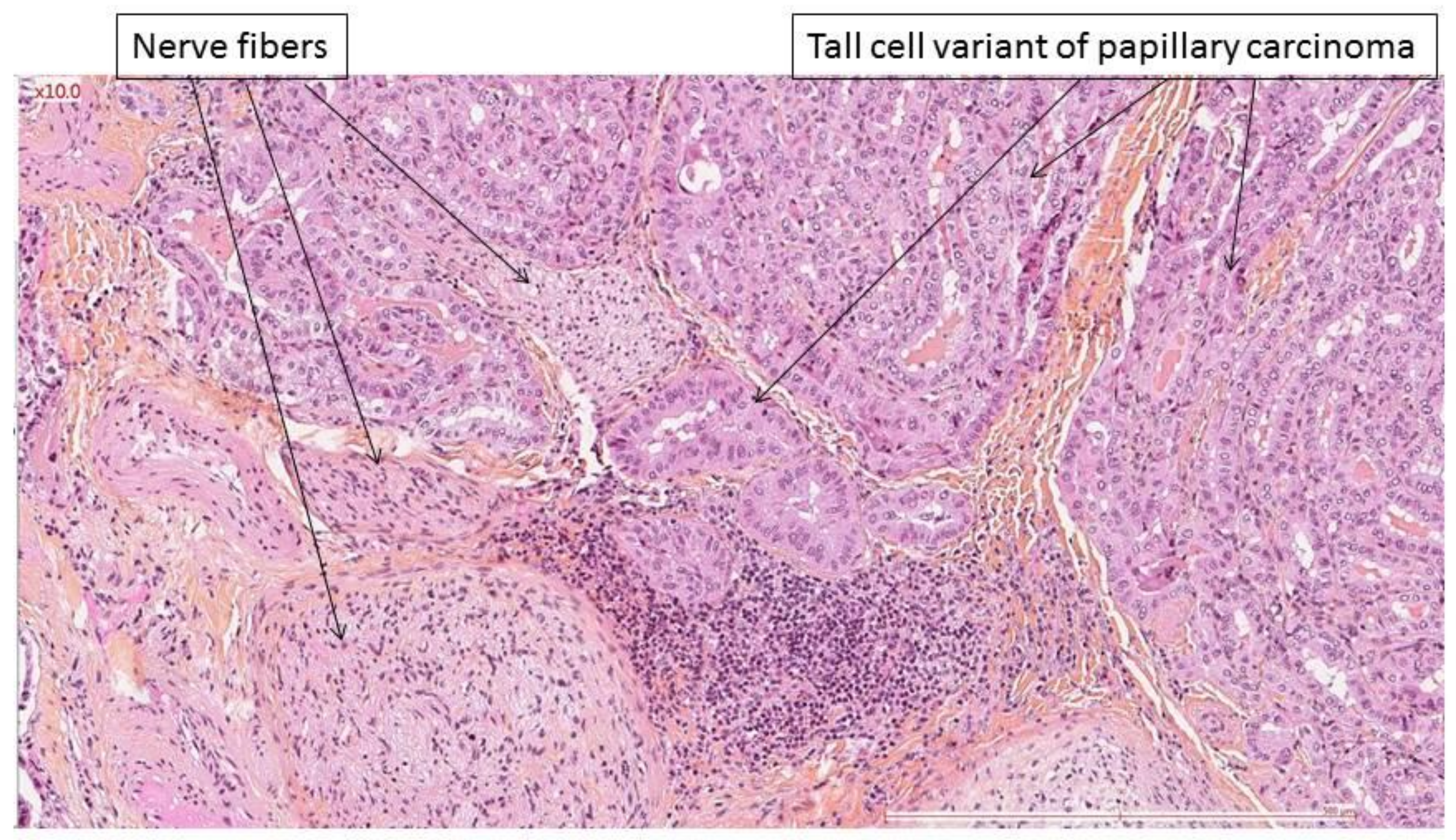 Cancers 14 02961 g003