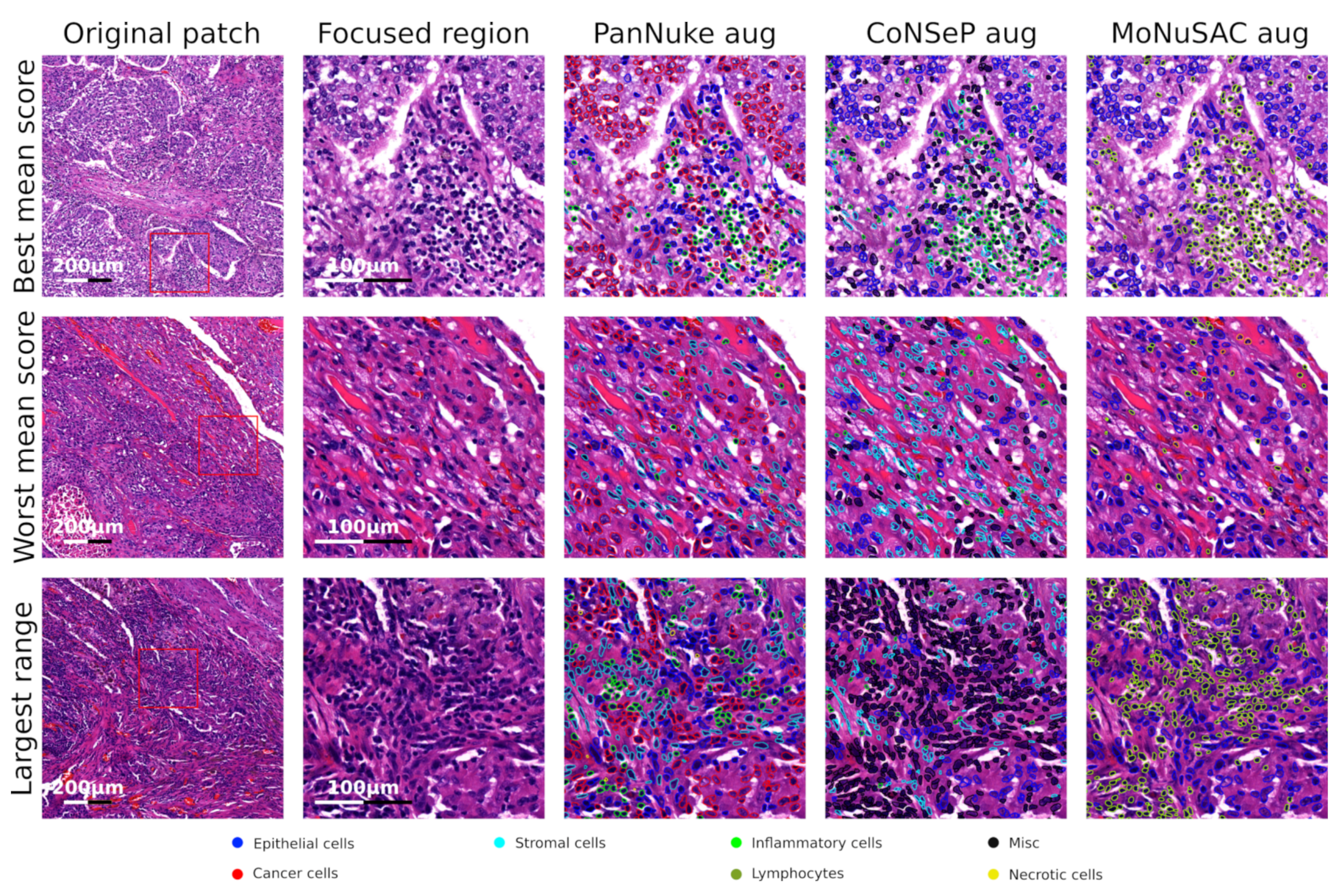 Cancers 14 02974 g005 550
