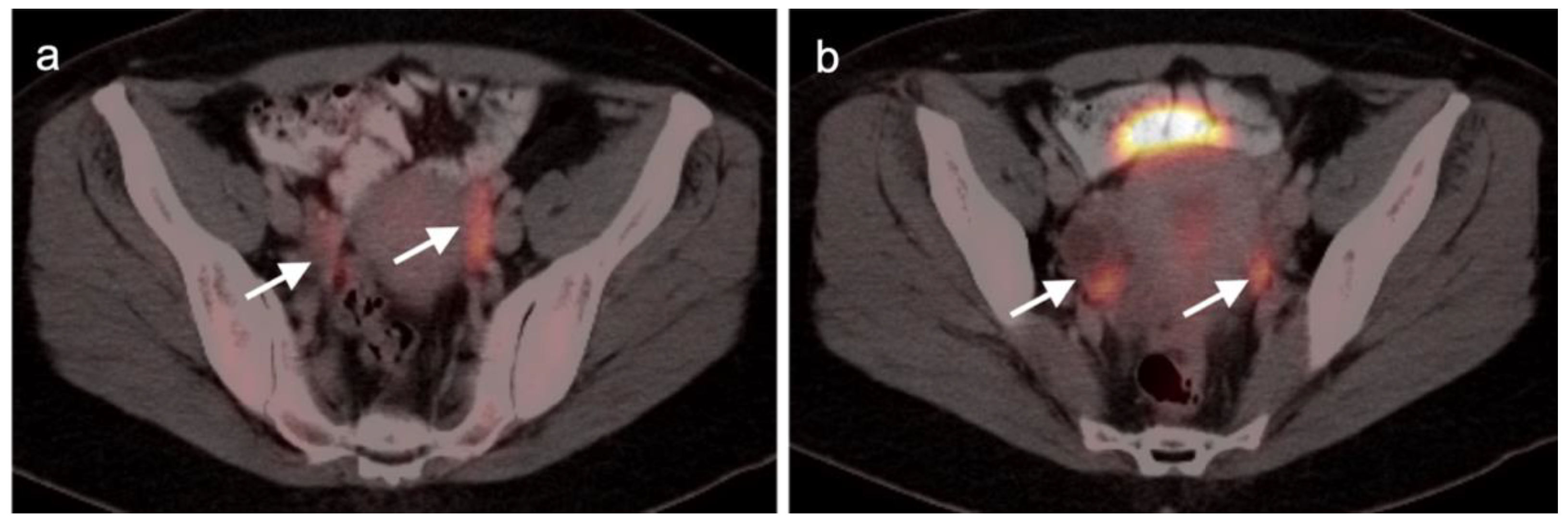 Cancers 14 03000 g004 Cancers 14 03000 g004