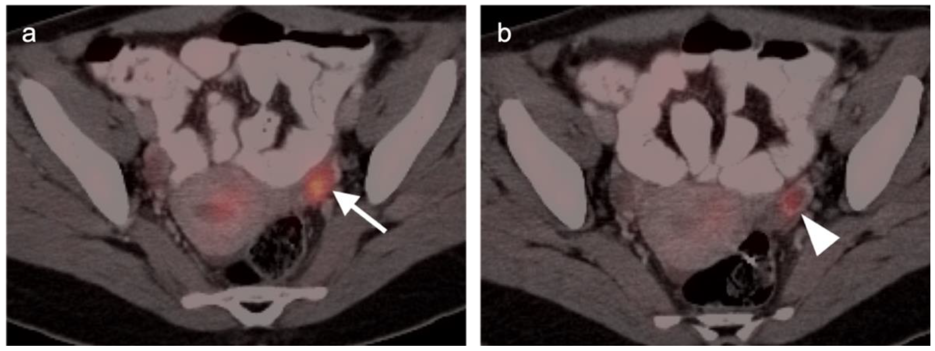 Cancers 14 03000 g005 Cancers 14 03000 g005