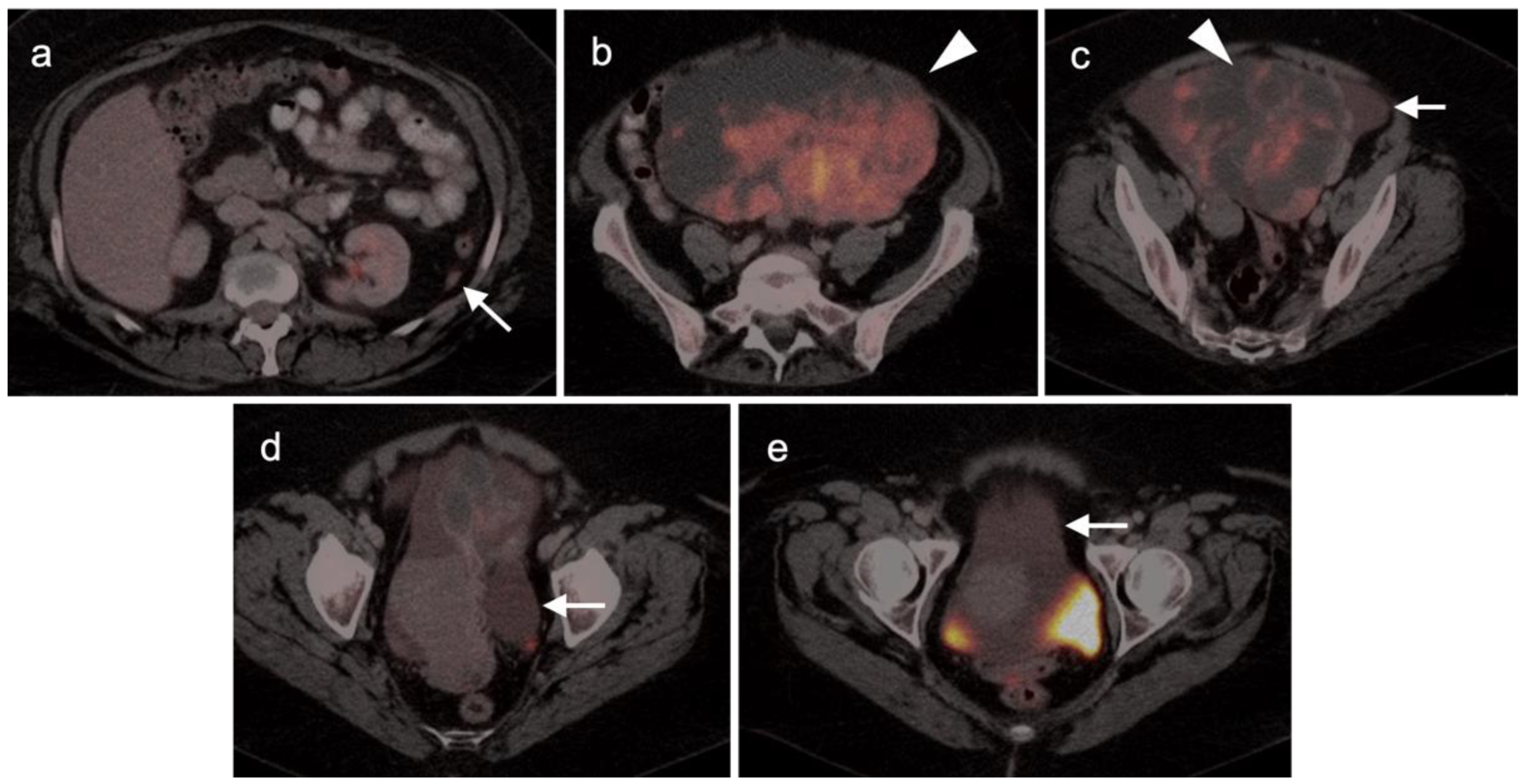 Cancers 14 03000 g009 Cancers 14 03000 g009