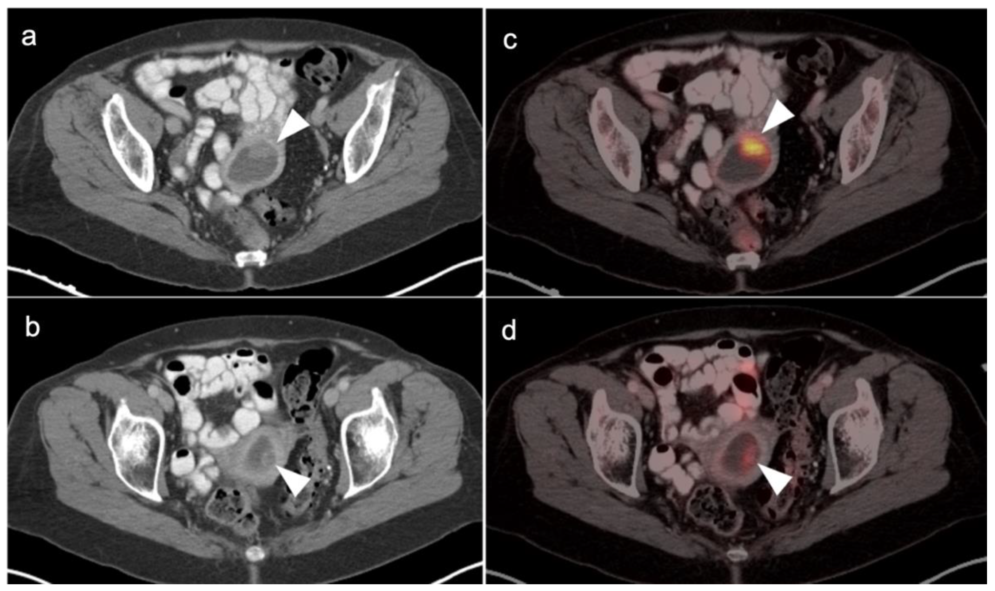 Cancers 14 03000 g013 Cancers 14 03000 g013