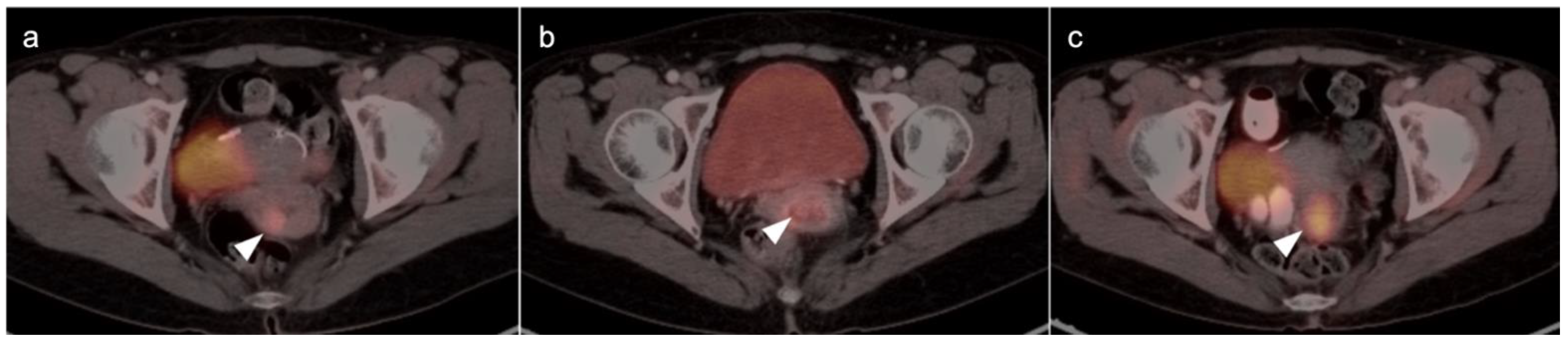 Cancers 14 03000 g015 Cancers 14 03000 g015