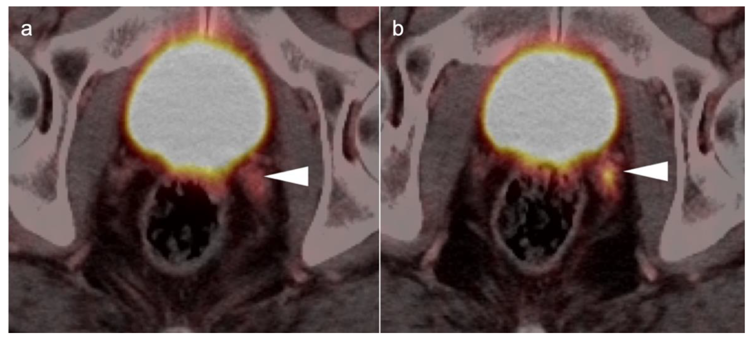 Cancers 14 03000 g033 Cancers 14 03000 g033