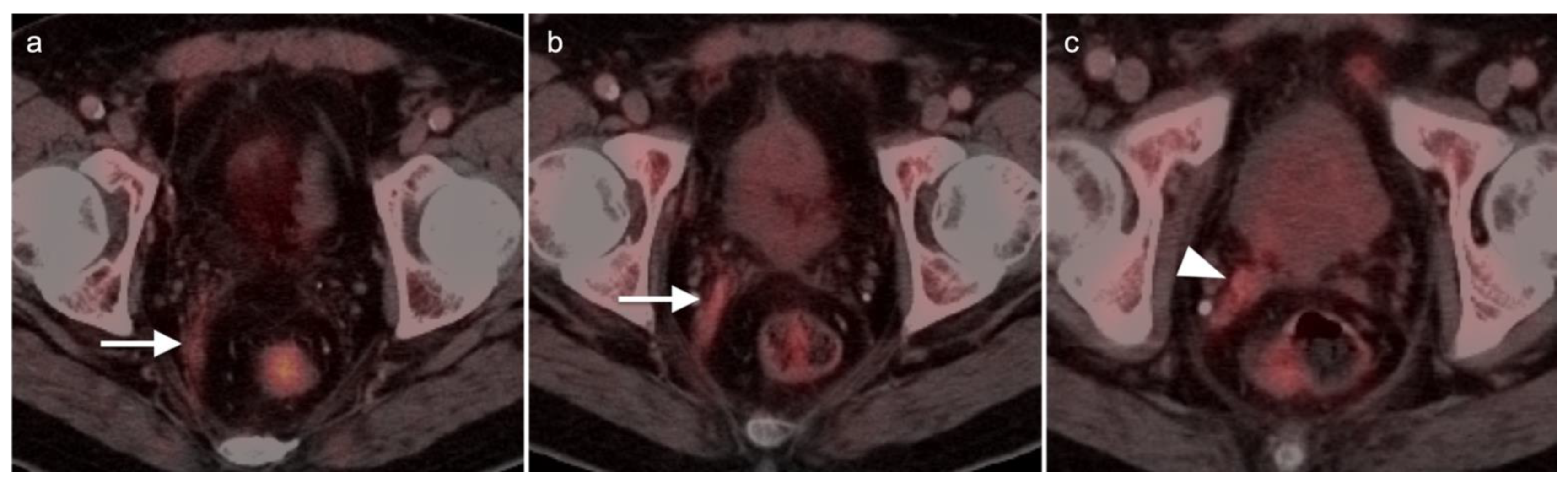 Cancers 14 03000 g034 Cancers 14 03000 g034